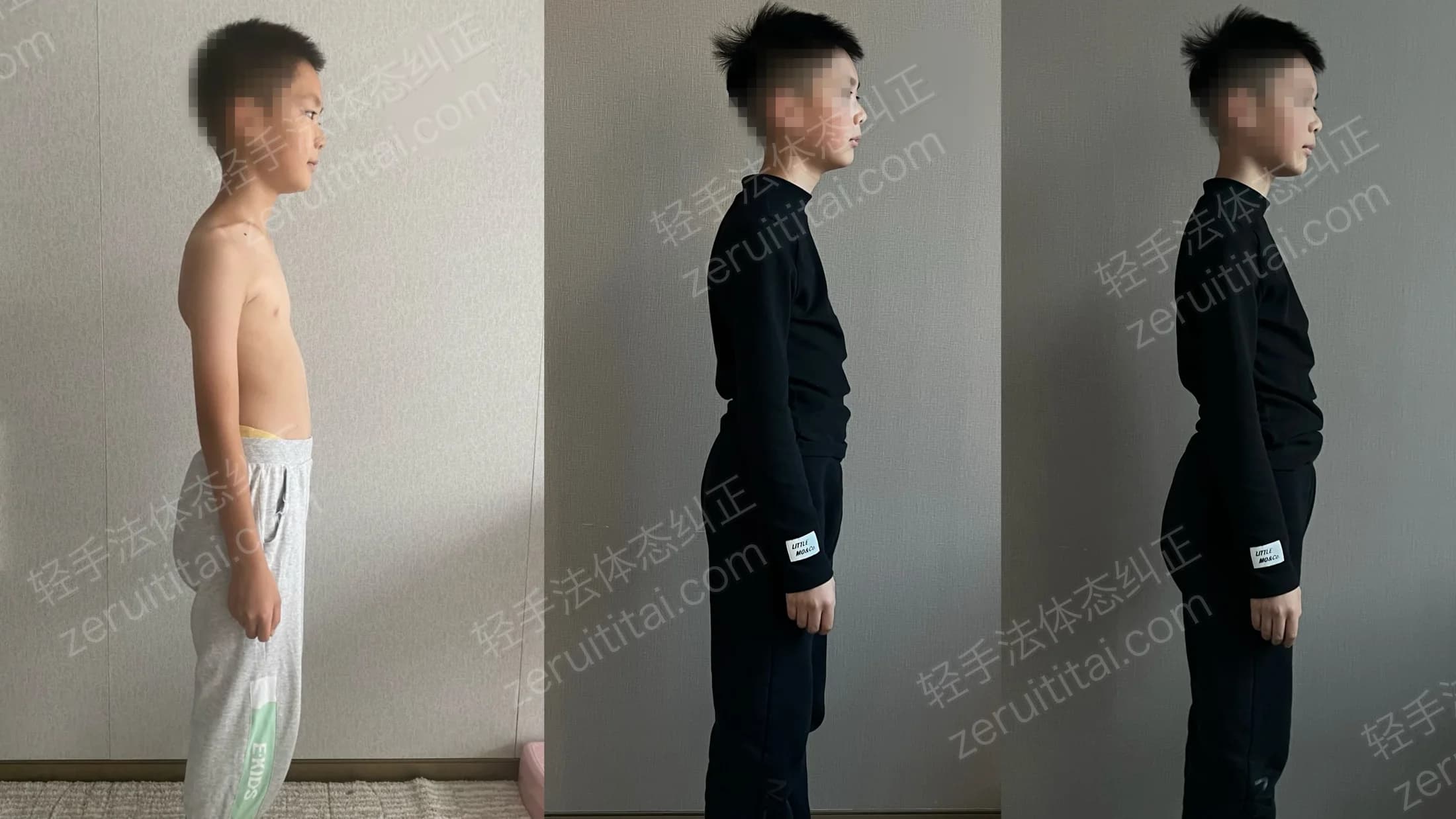 多次矫正阶段对比 17