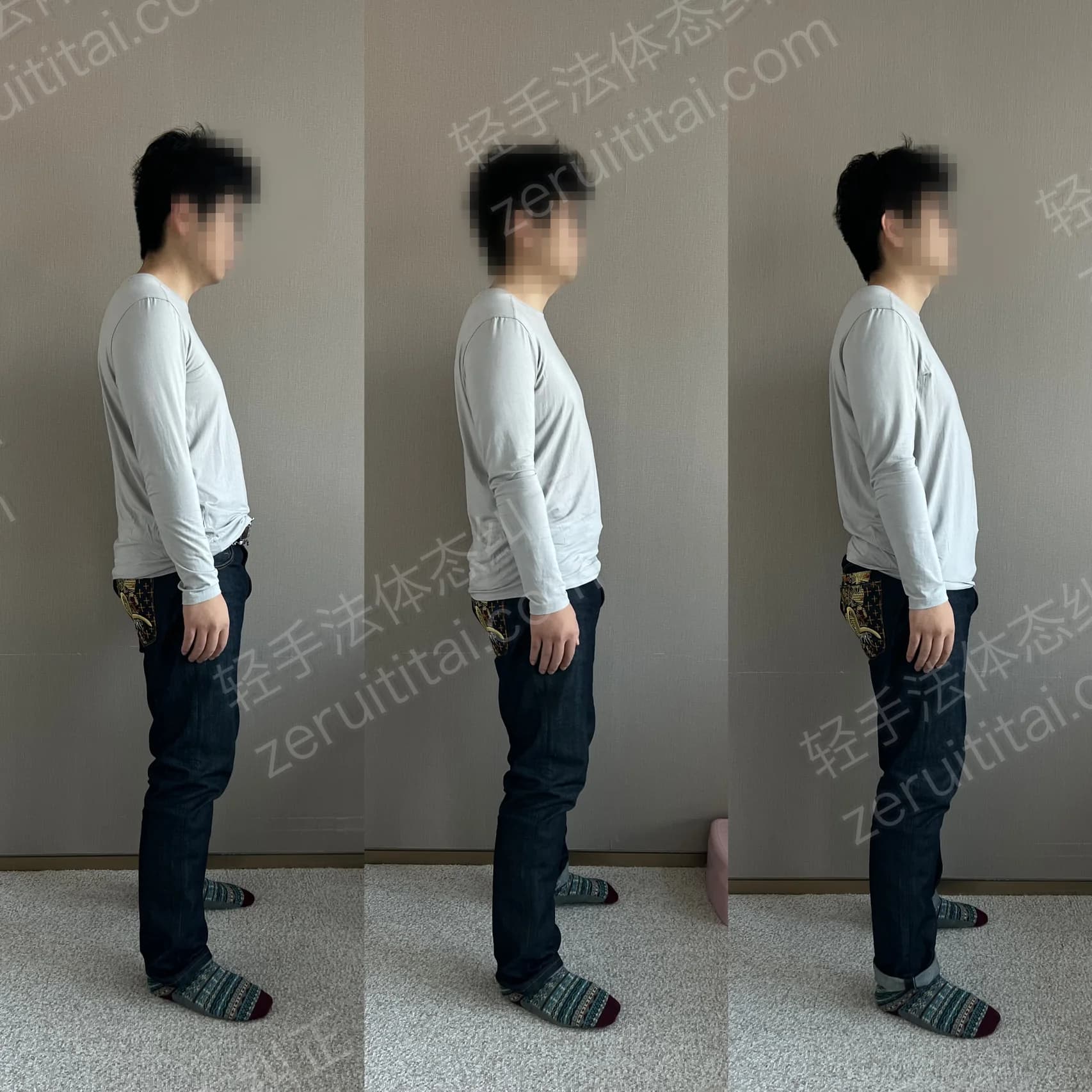 多次矫正阶段对比 24