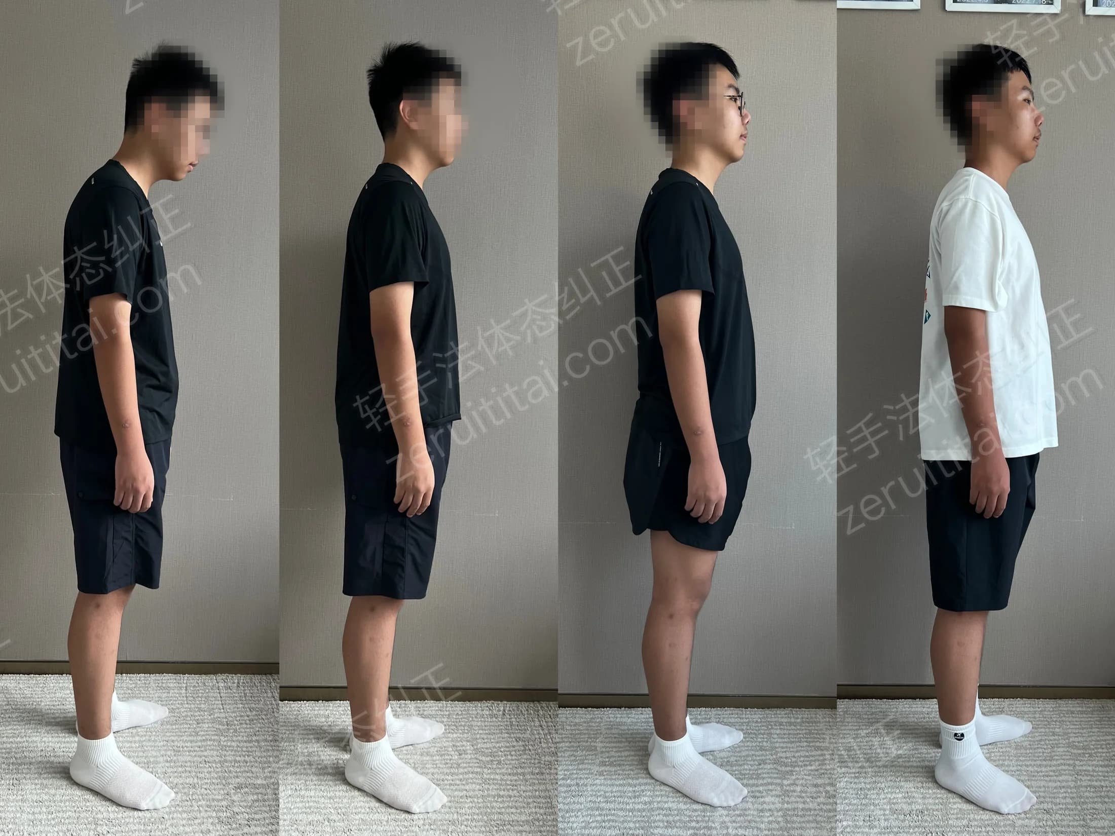多次矫正阶段对比 30