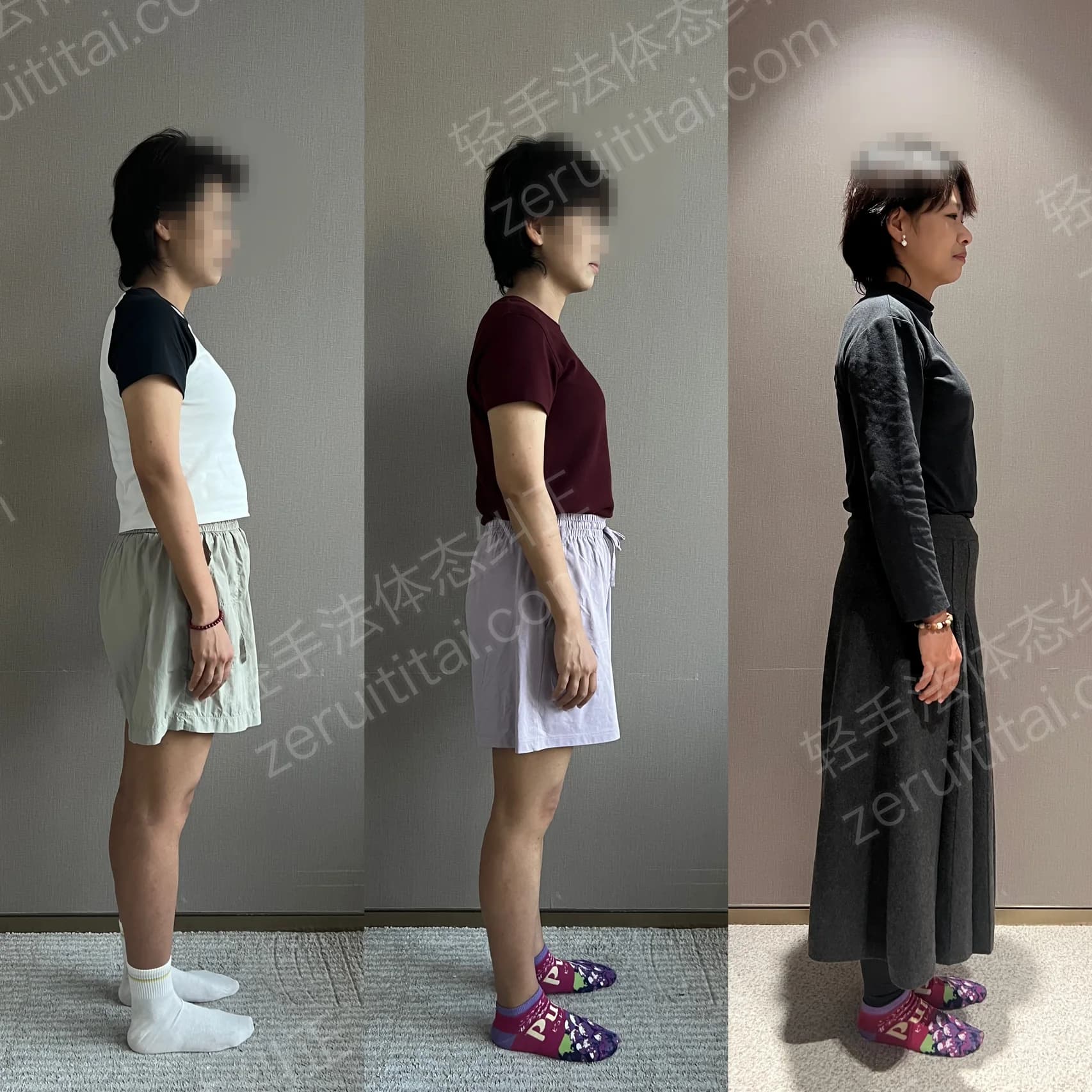 多次矫正阶段对比 35