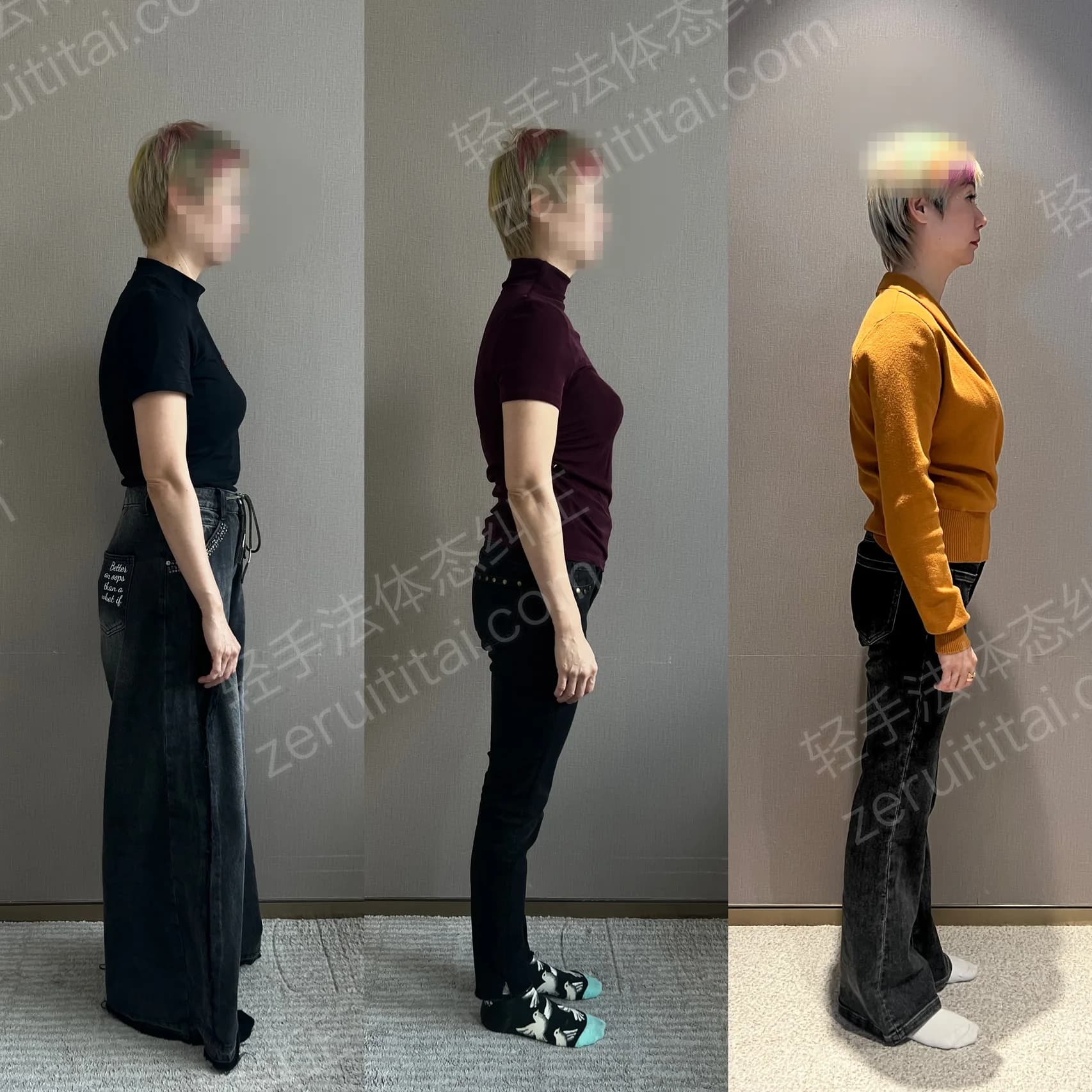 多次矫正阶段对比 36