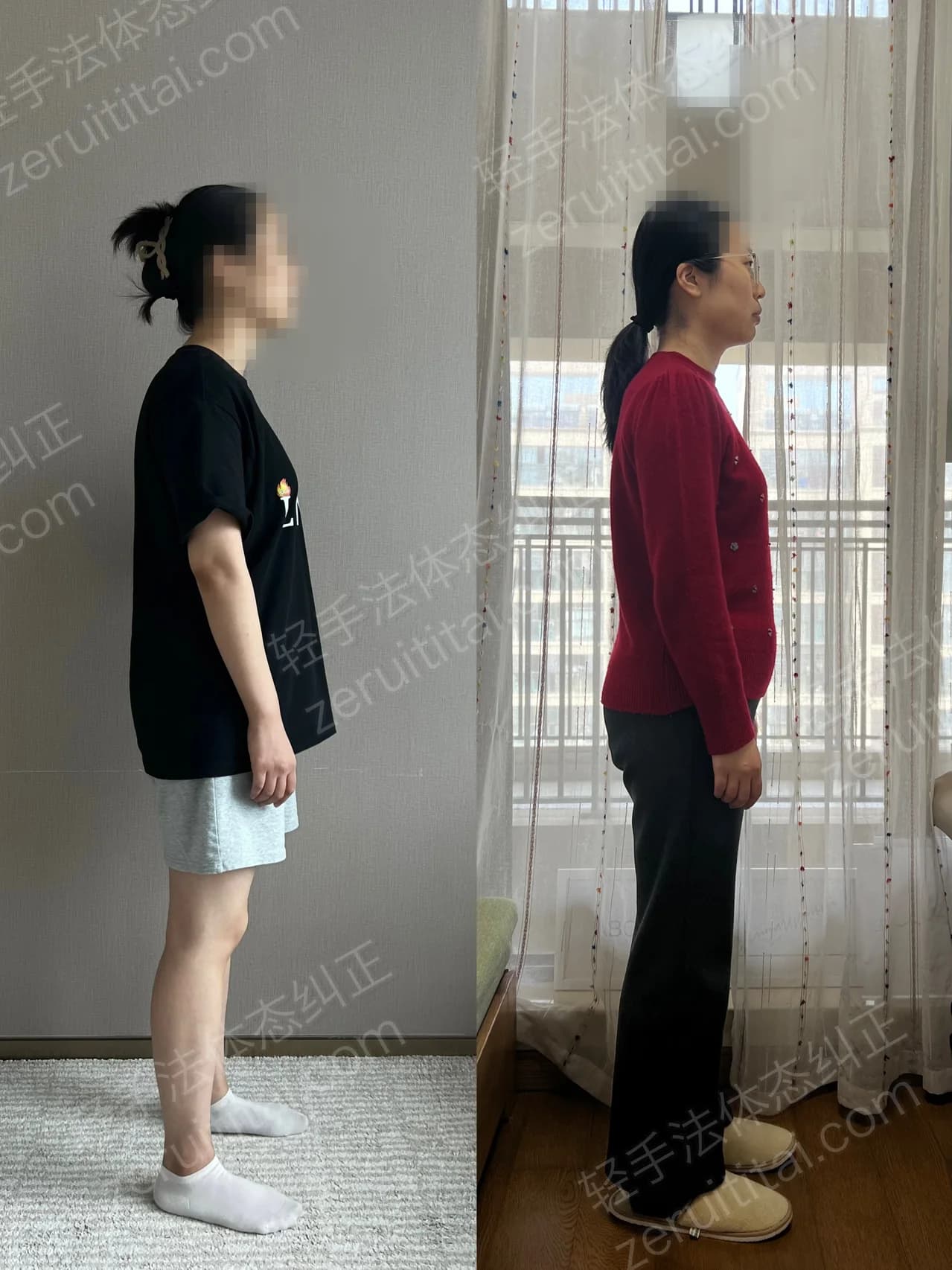 单次矫正案例对比 62