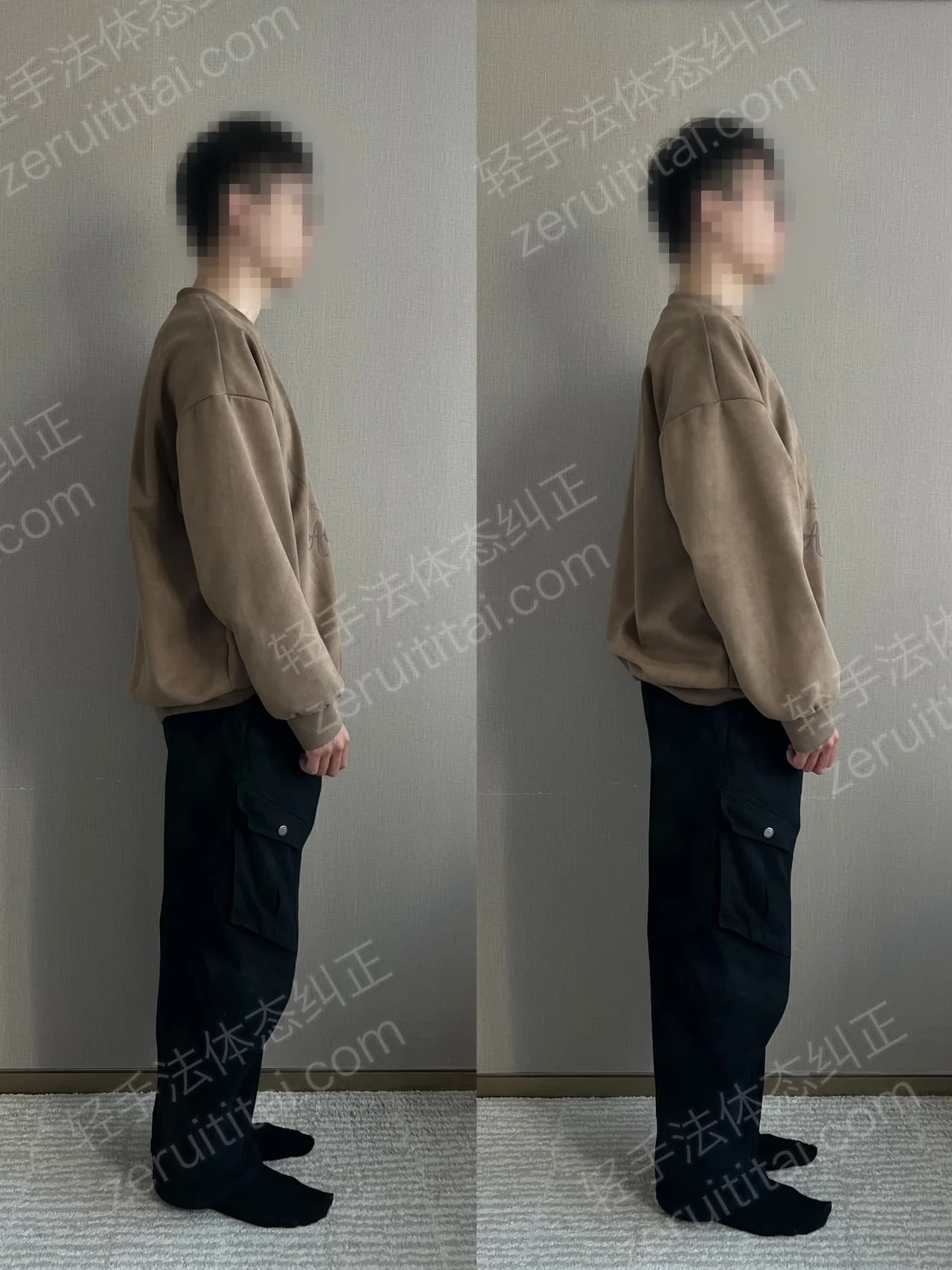 单次矫正案例对比 63