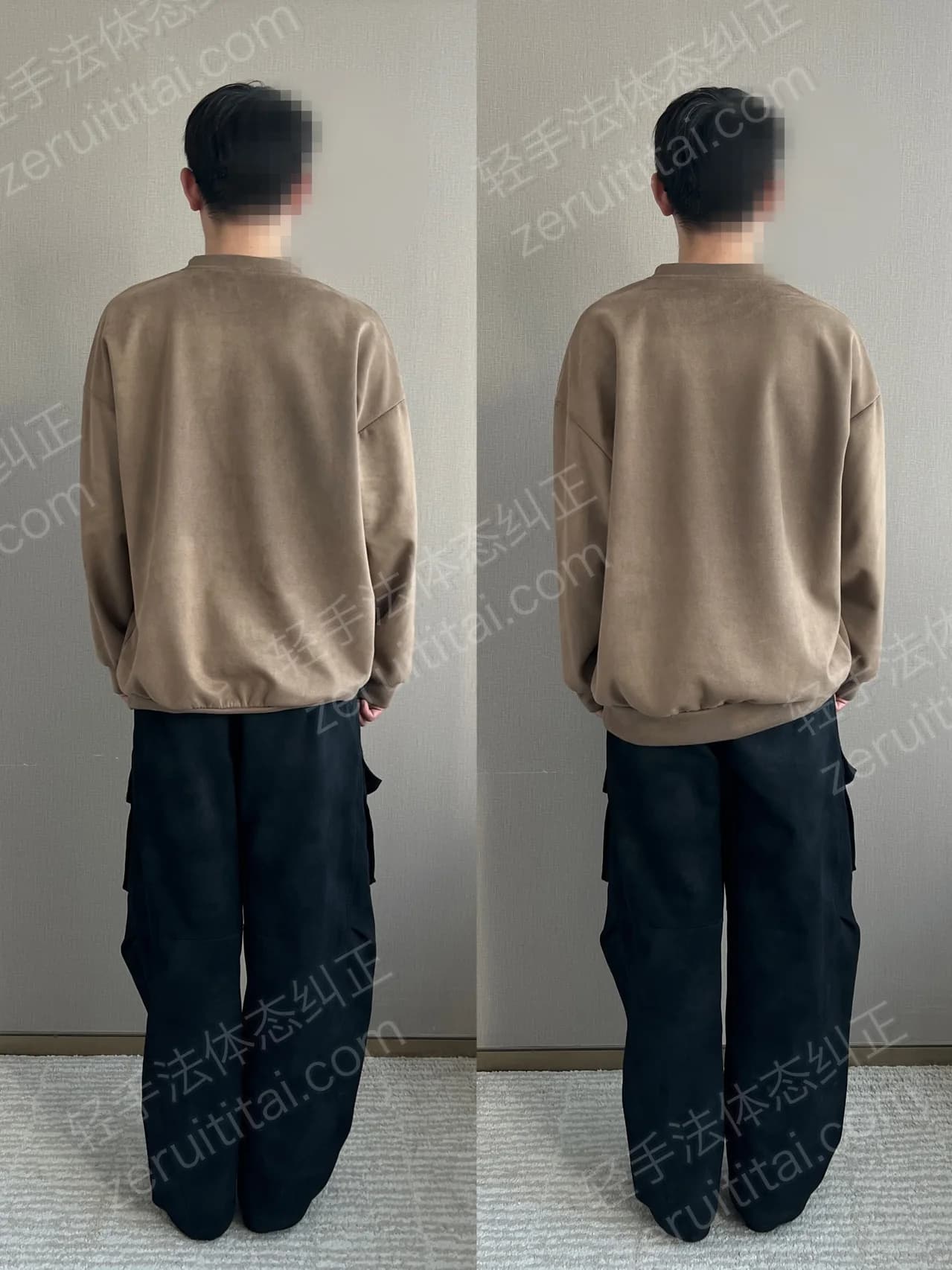 单次矫正案例对比 64