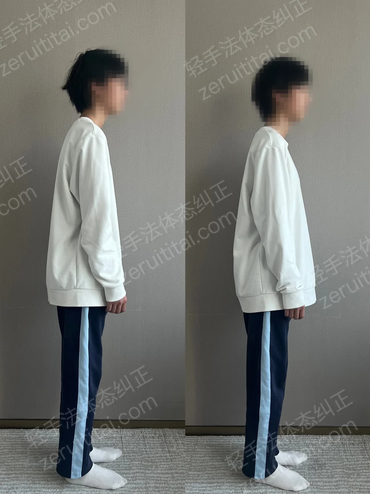 单次矫正案例对比 66