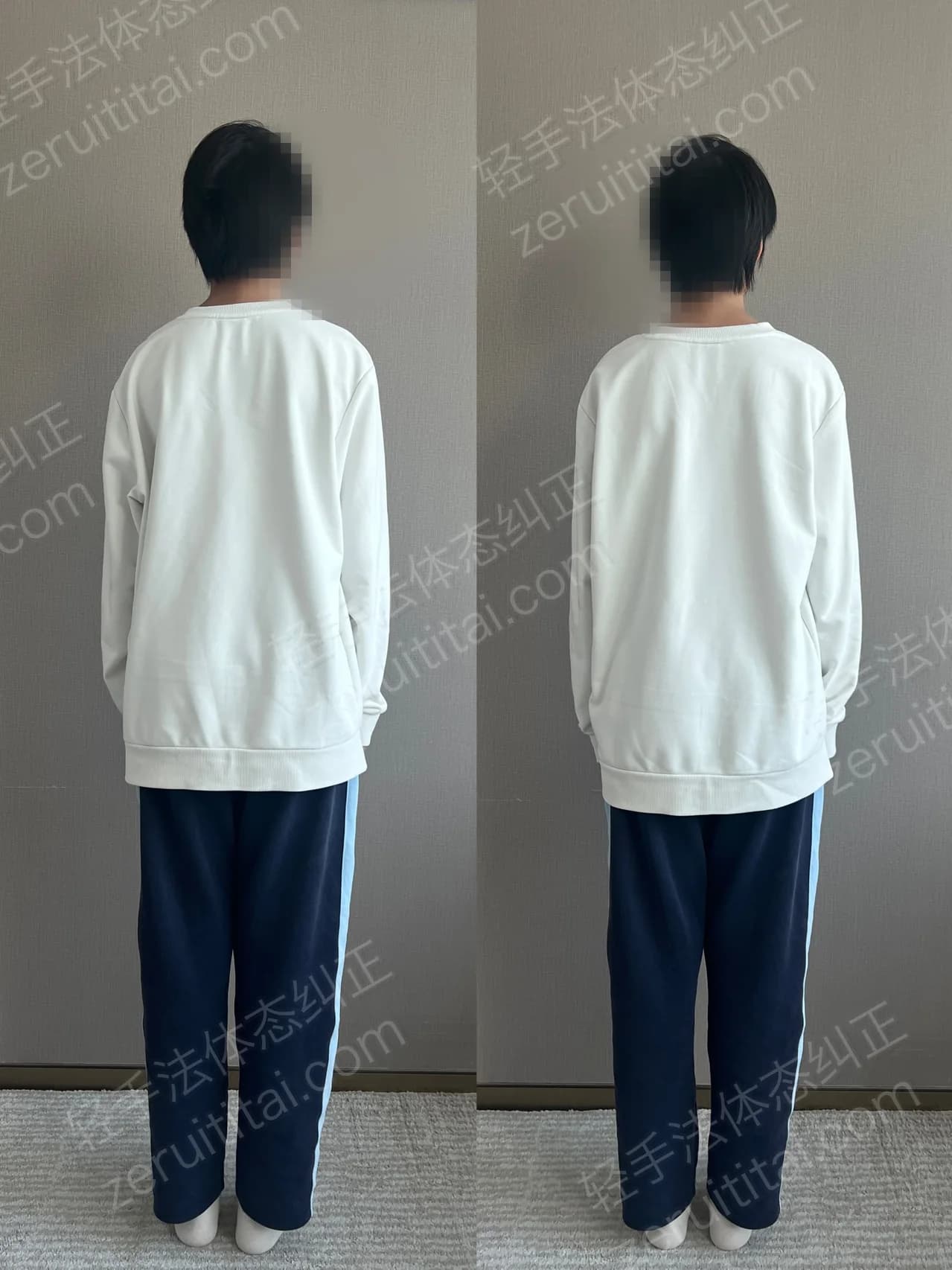 单次矫正案例对比 67