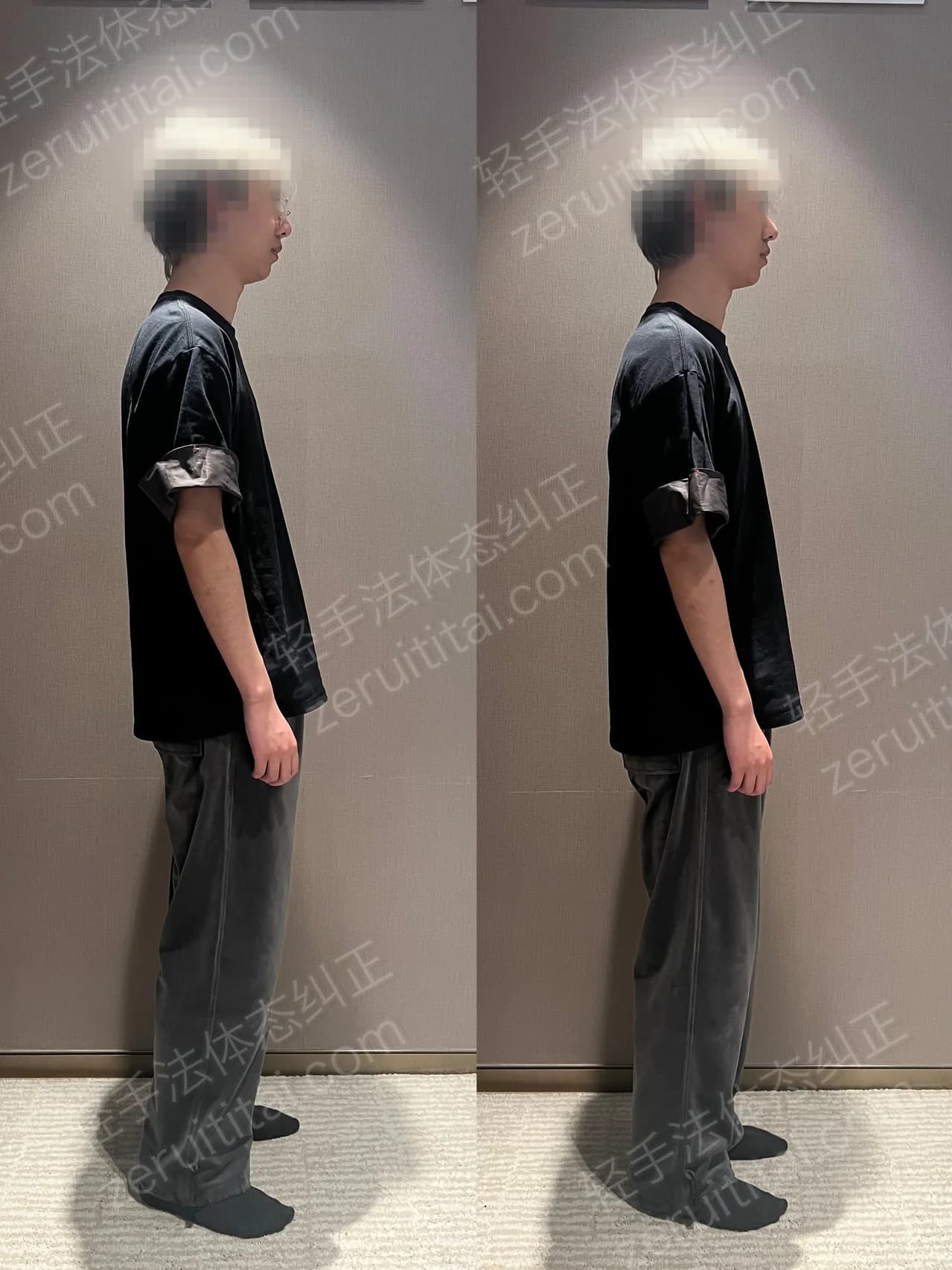 单次矫正案例对比 69