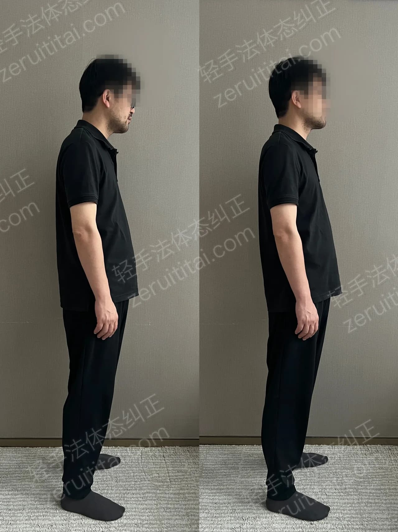 单次矫正案例对比 70