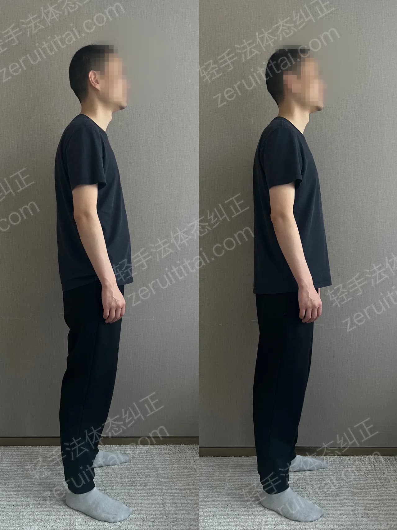 单次矫正案例对比 71
