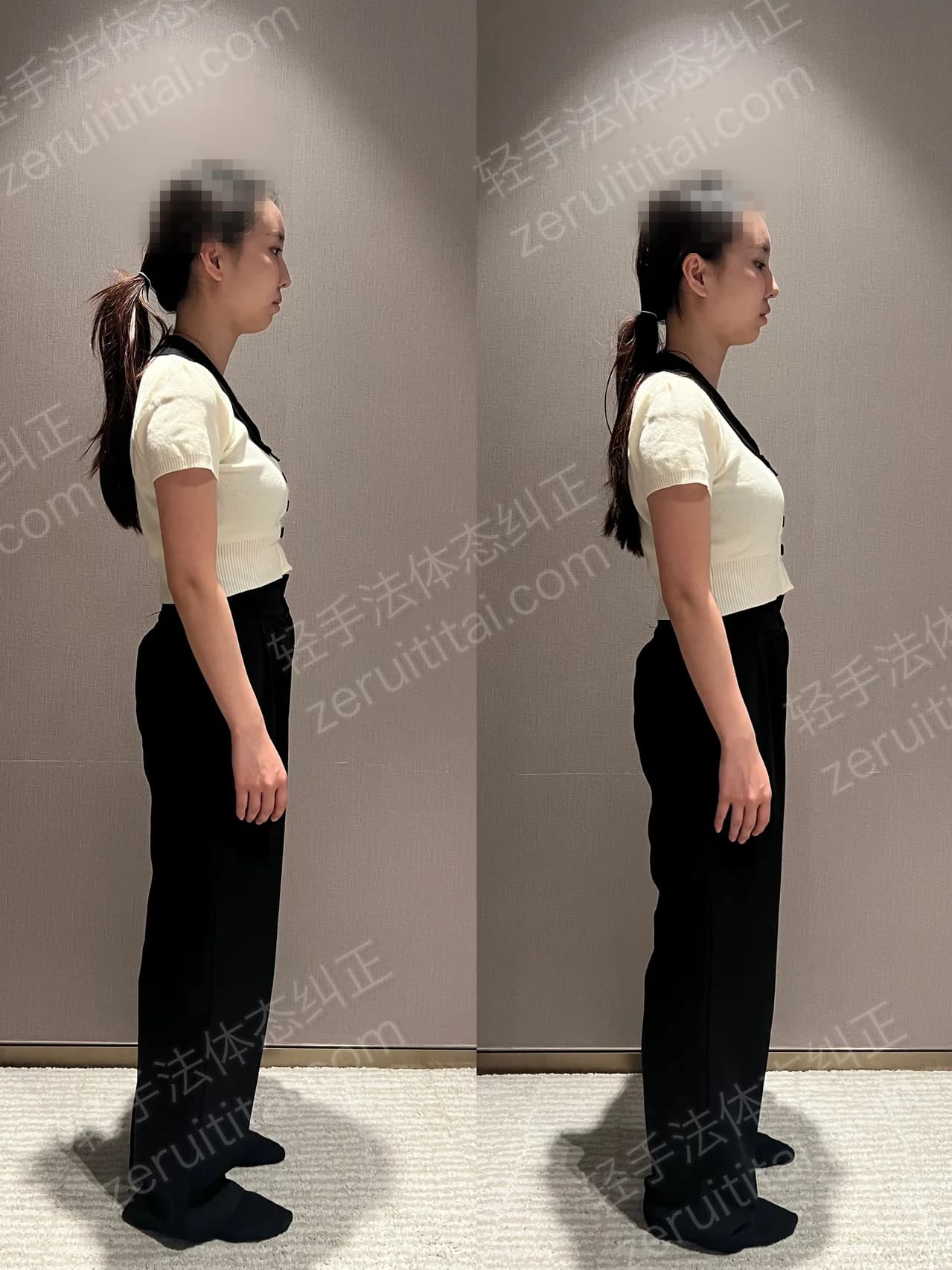 单次矫正案例对比 72