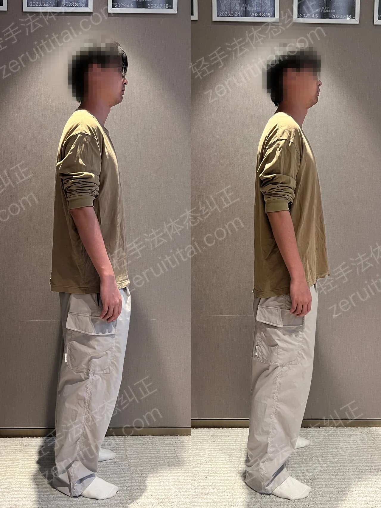 单次矫正案例对比 73