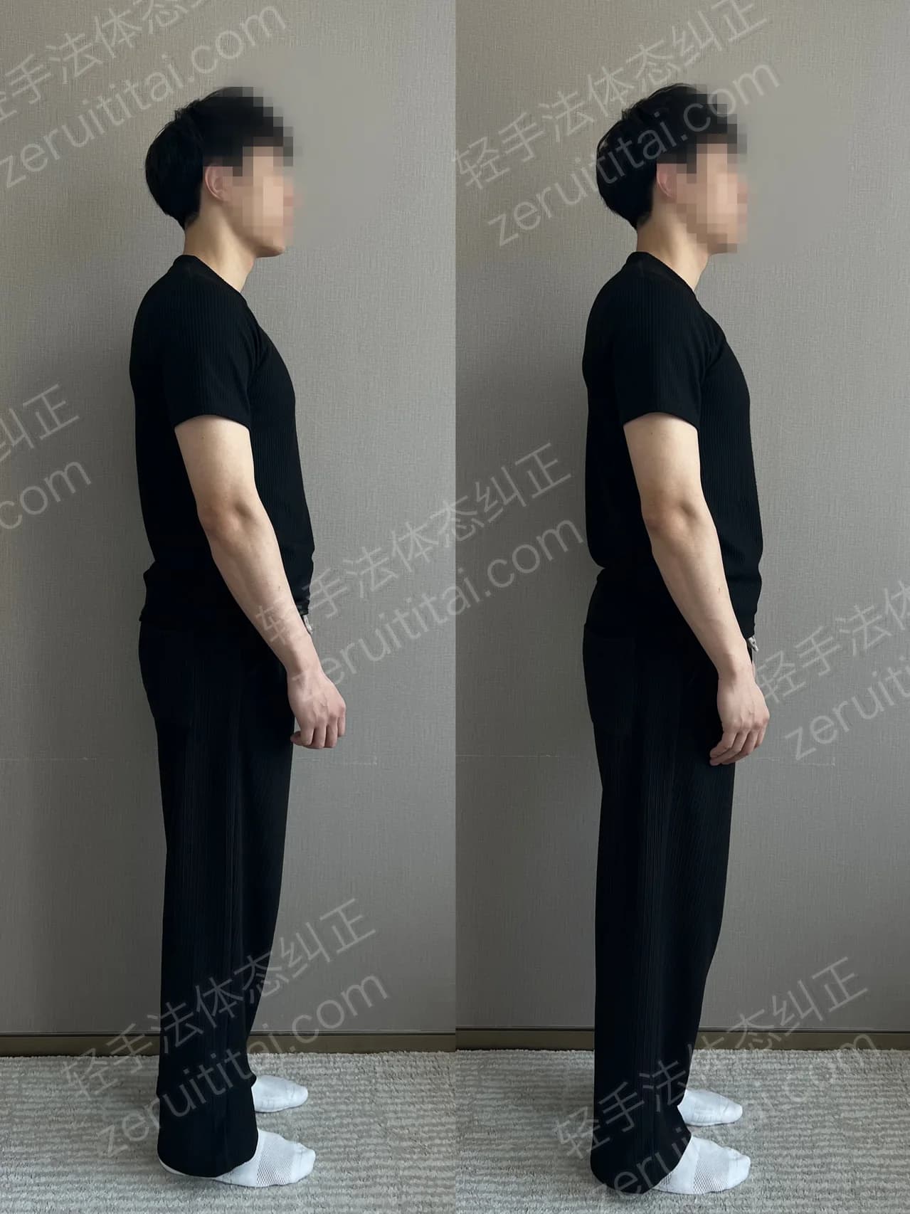 单次矫正案例对比 75