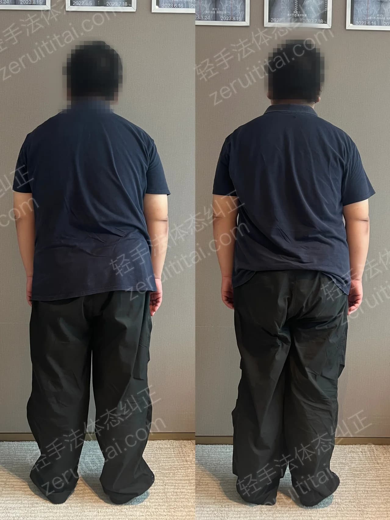 单次矫正案例对比 77