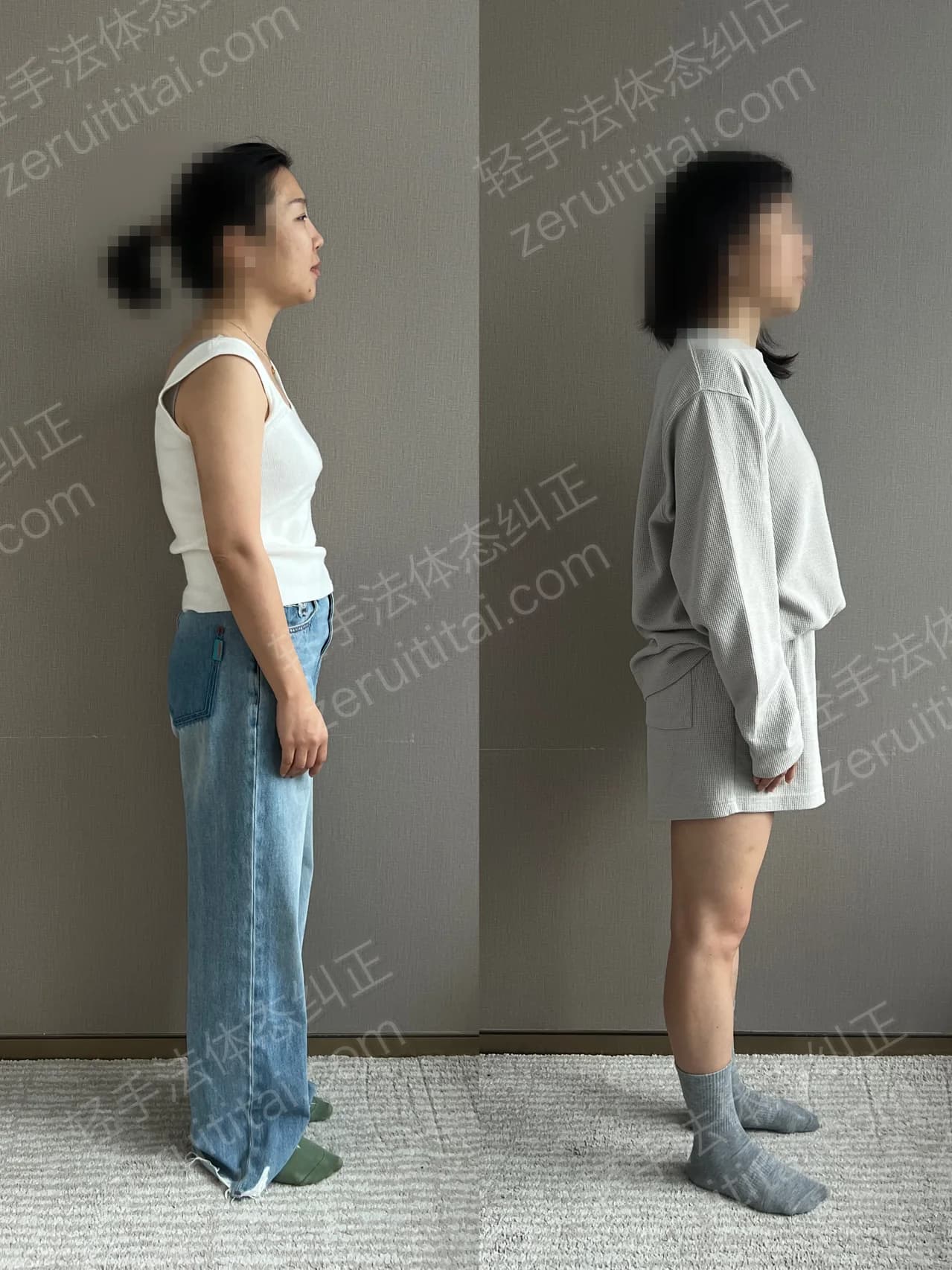 单次矫正案例对比 81