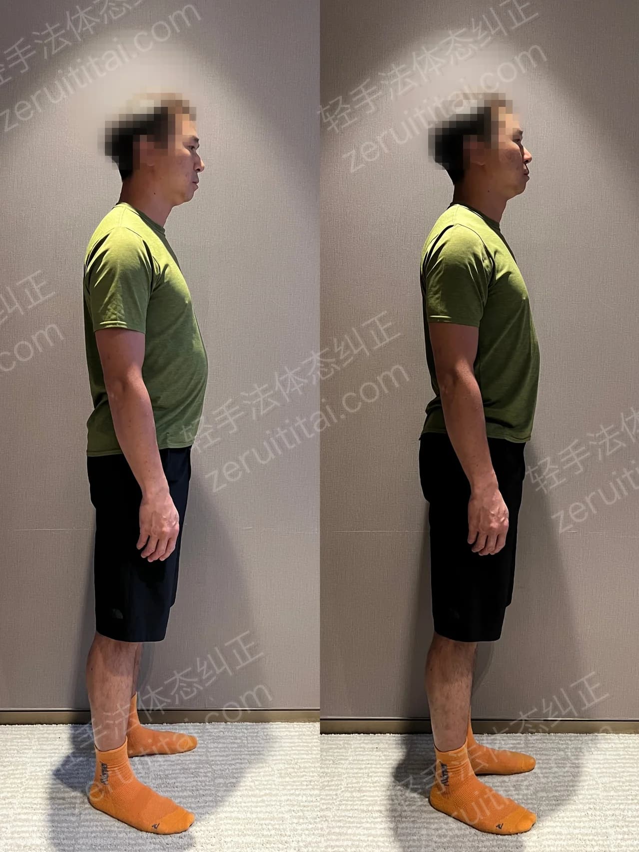 单次矫正案例对比 83