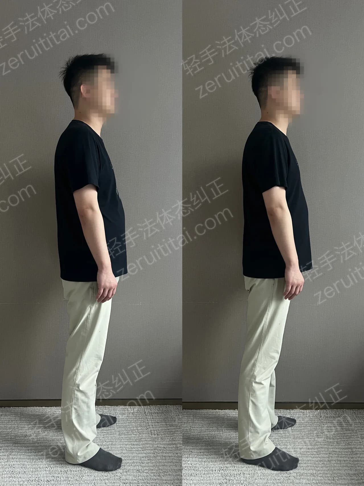 单次矫正案例对比 87