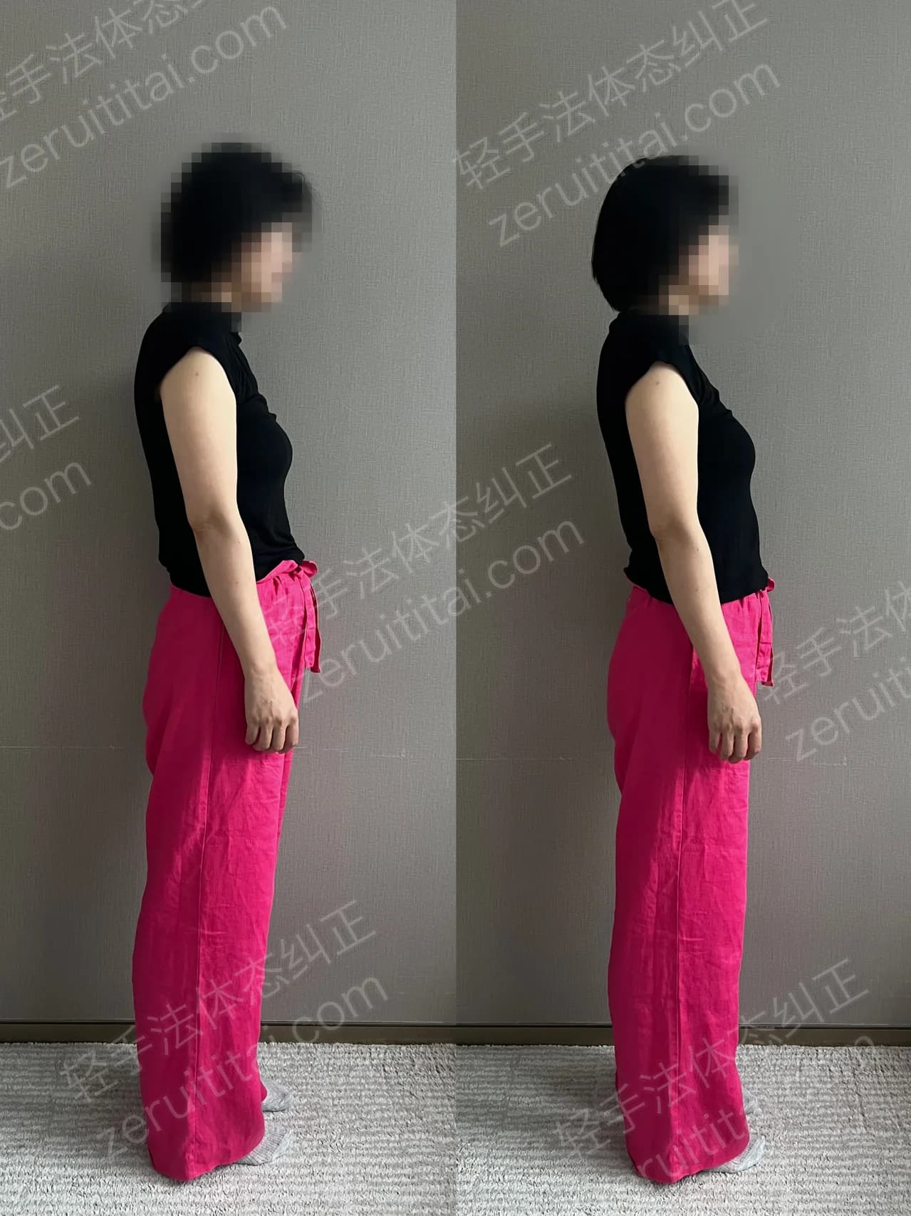 单次矫正案例对比 88