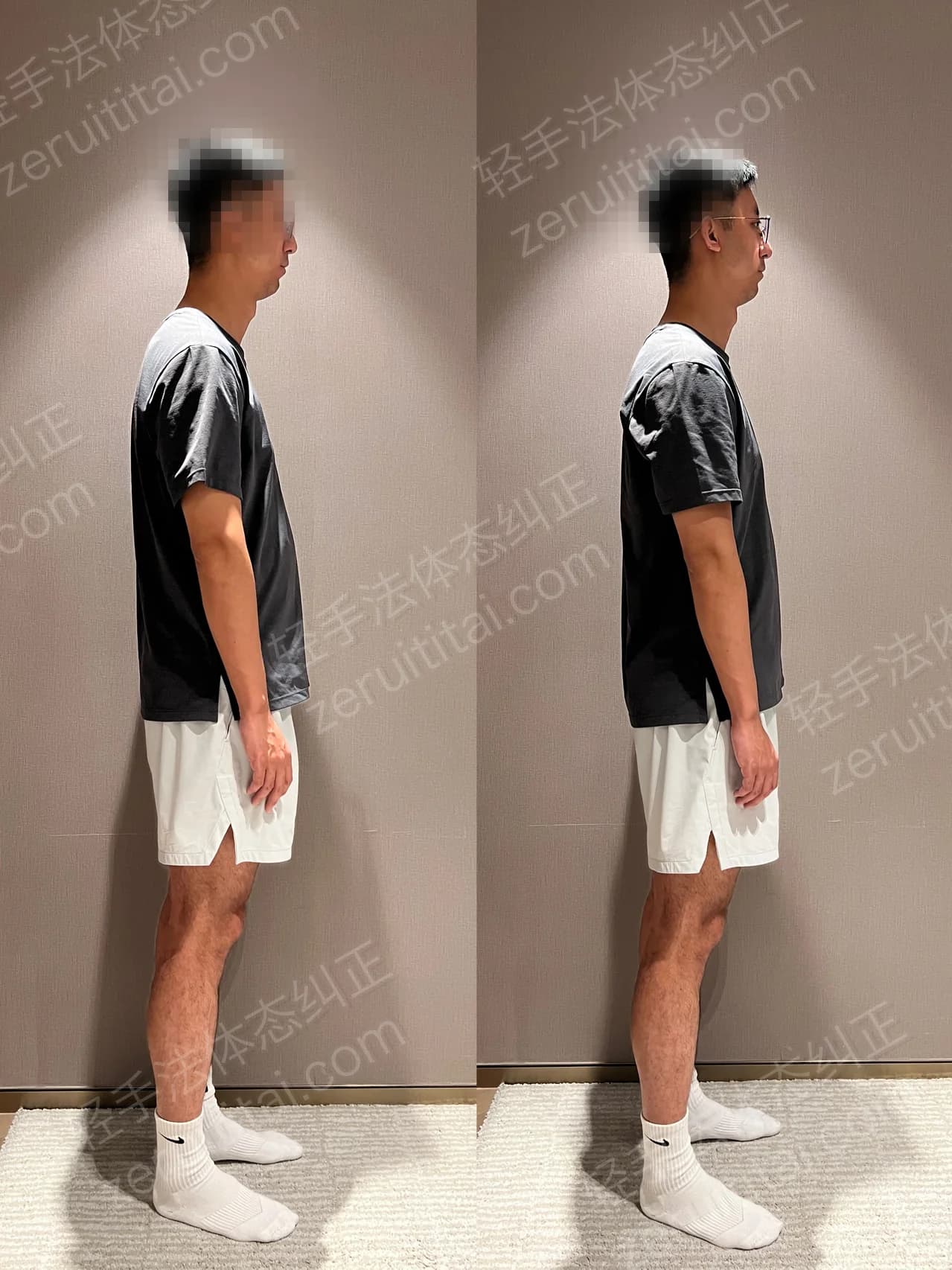 单次矫正案例对比 91