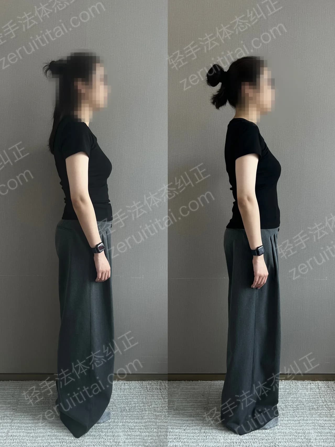 单次矫正案例对比 95