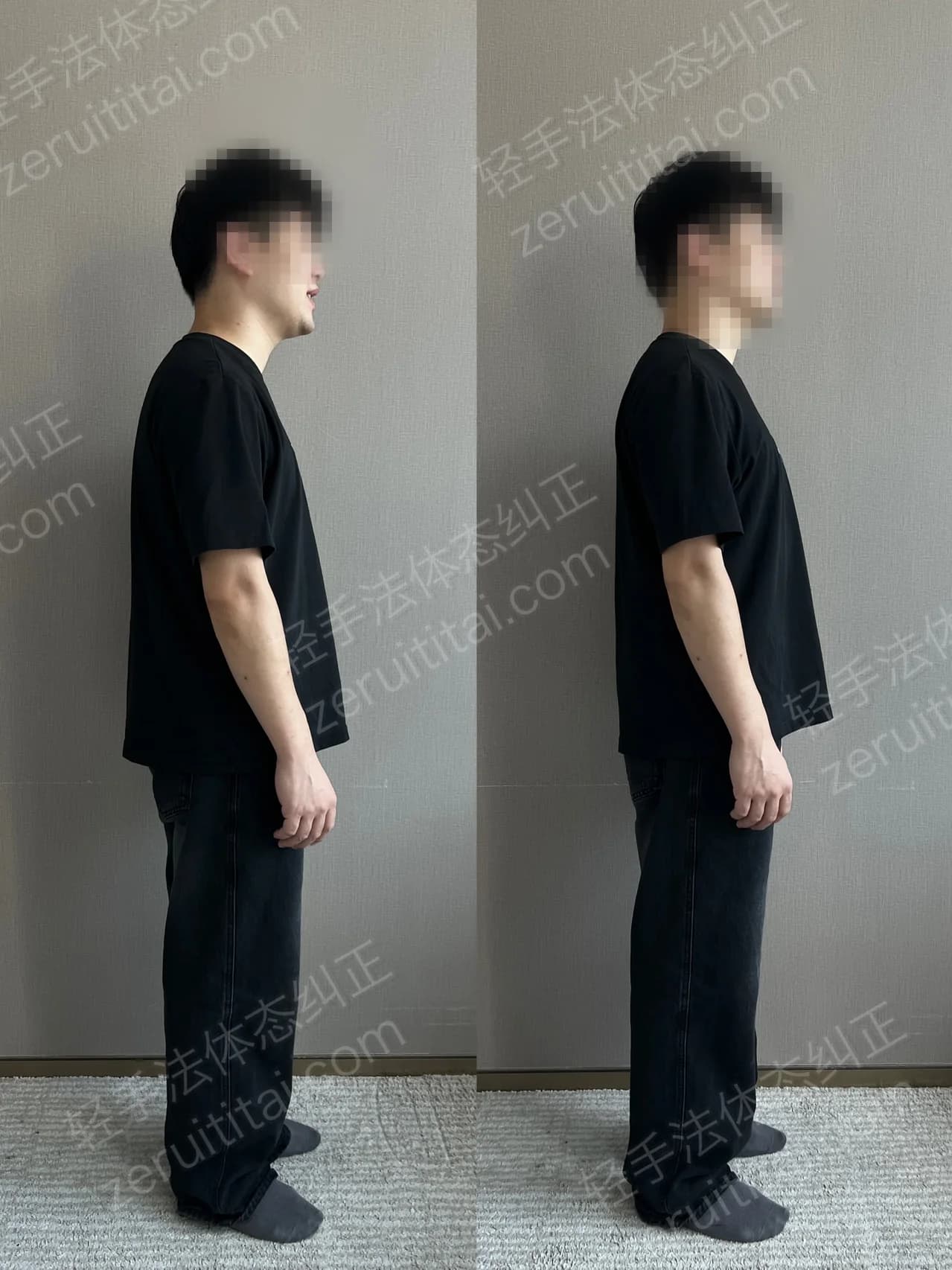 单次矫正案例对比 96