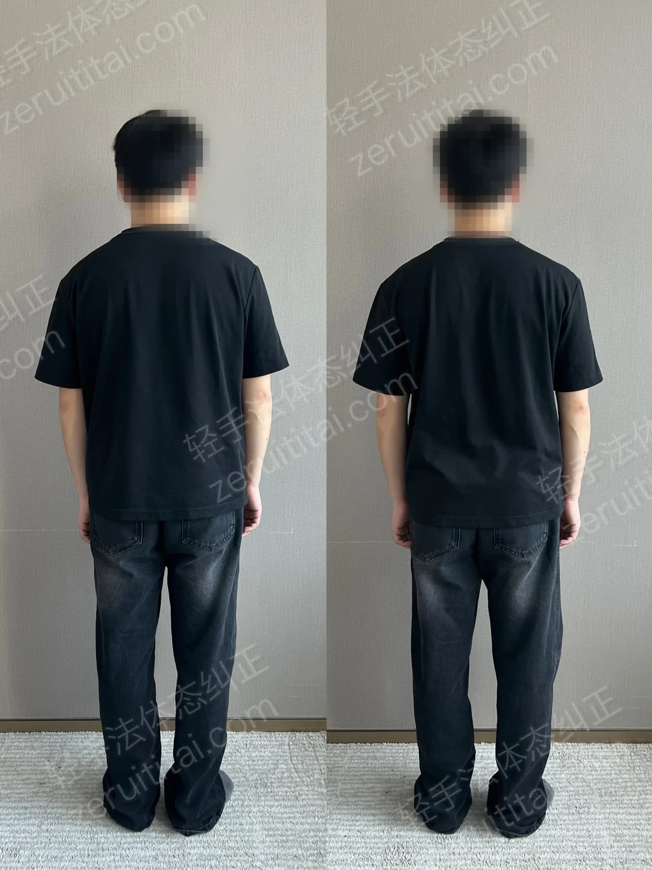 单次矫正案例对比 97