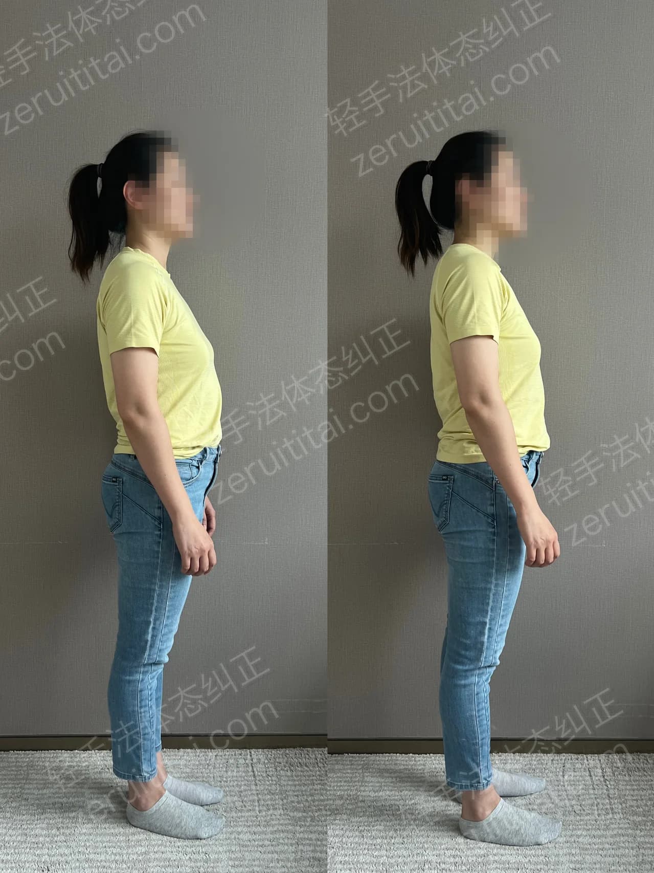 单次矫正案例对比 100