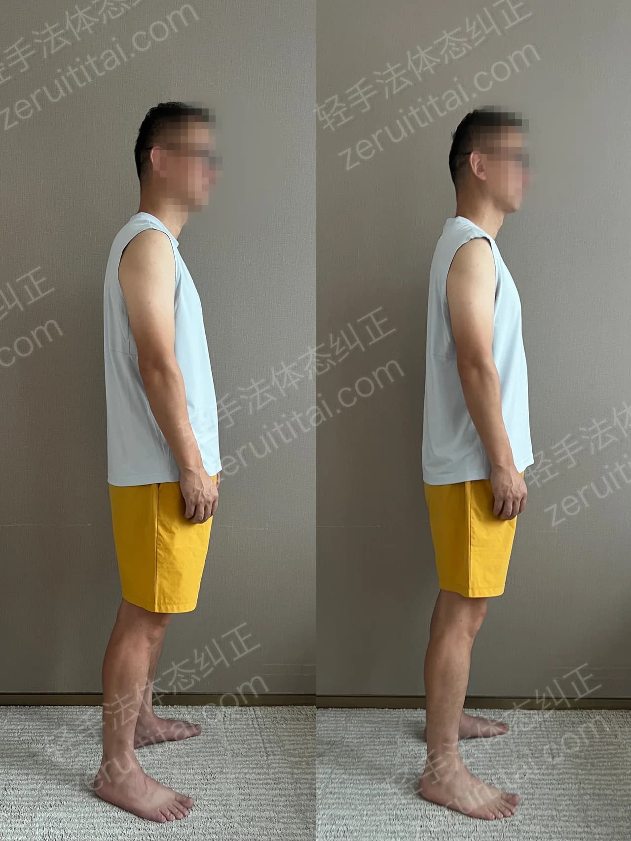 单次矫正案例对比 101