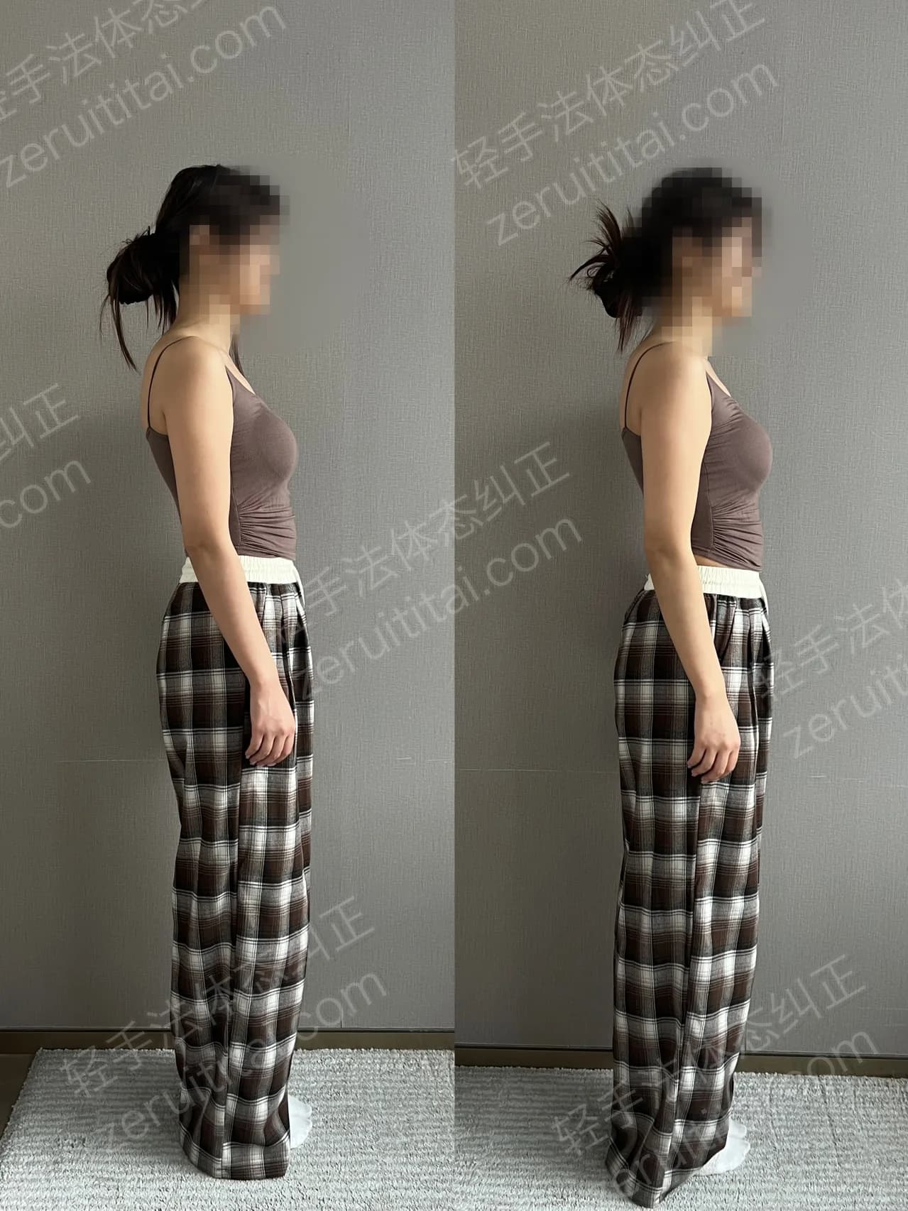 单次矫正案例对比 105