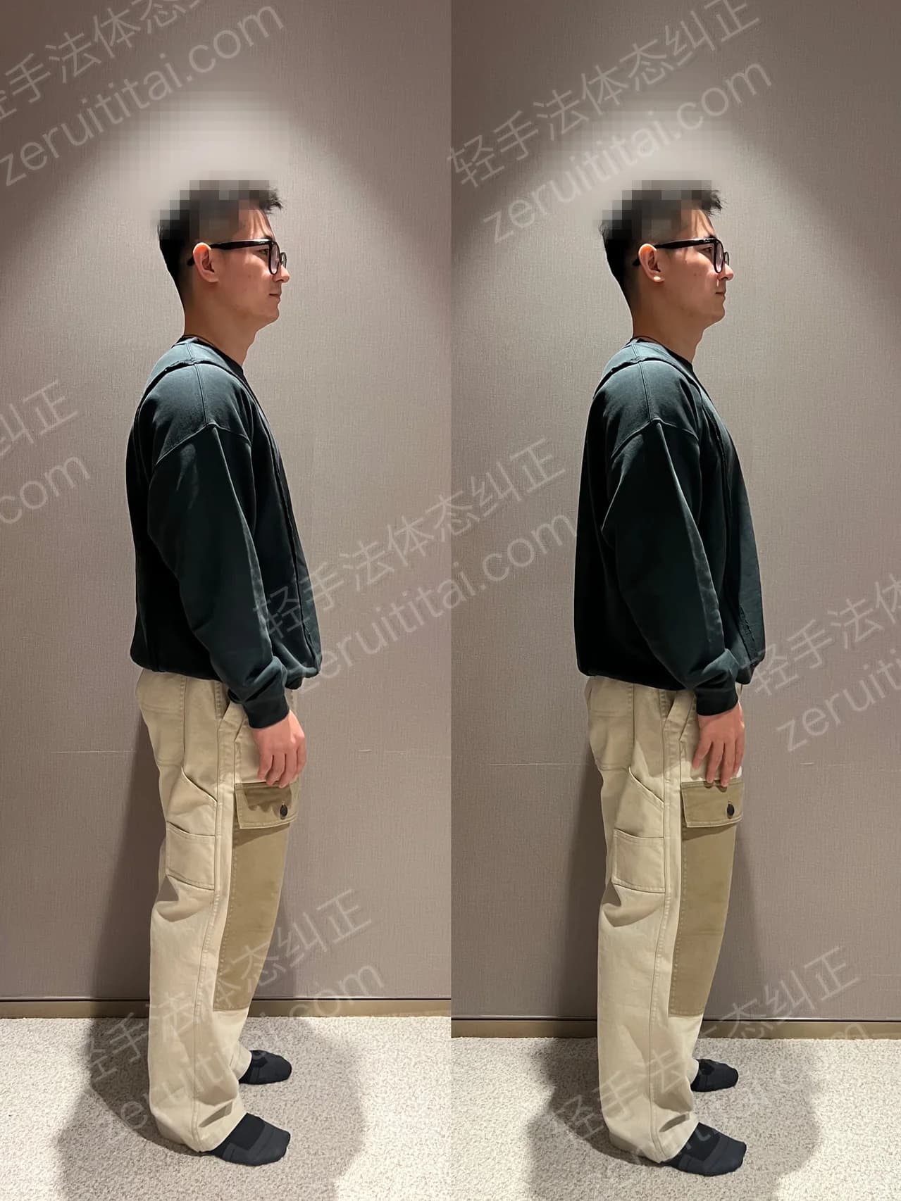 单次矫正案例对比 106