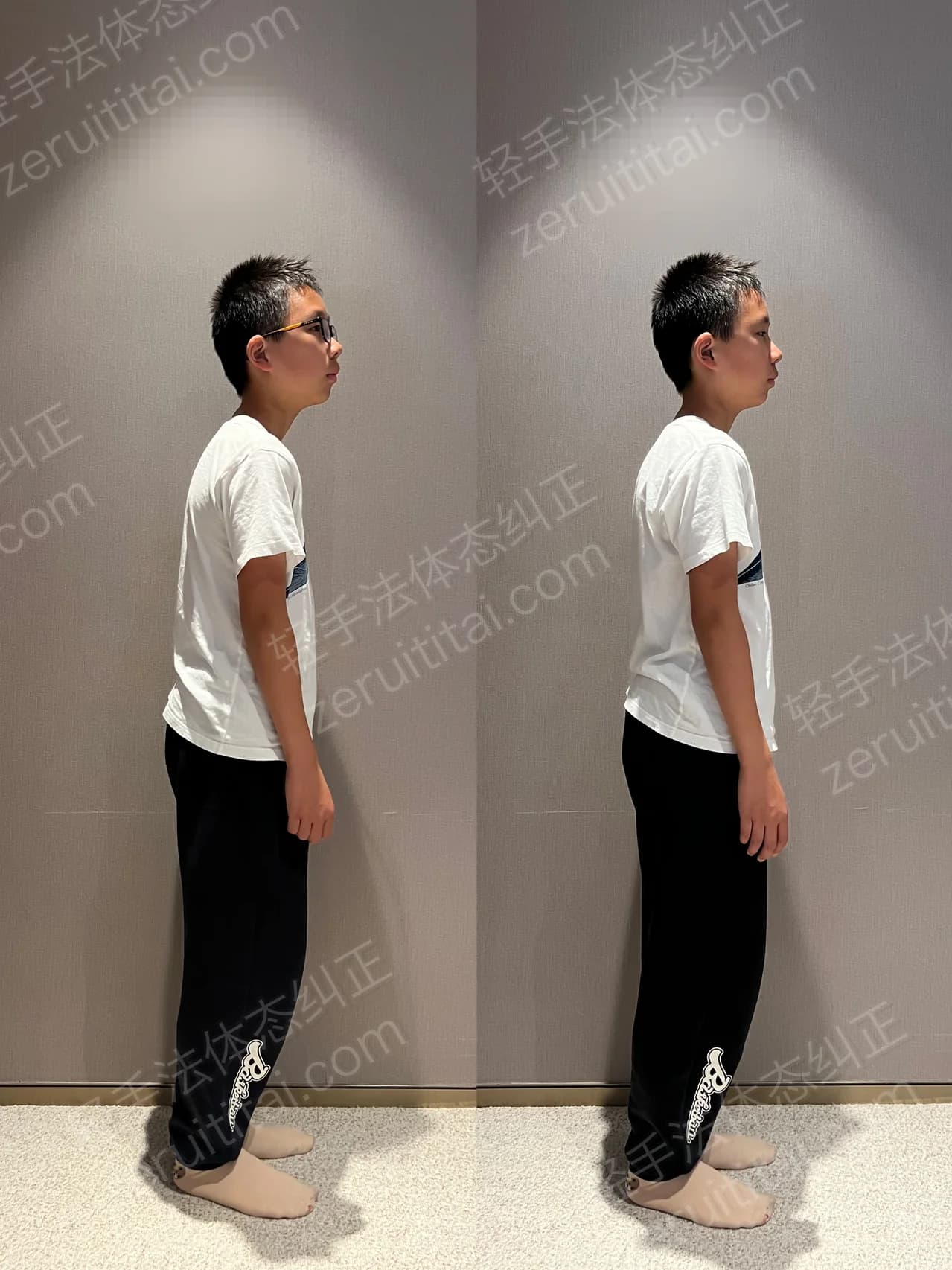 单次矫正案例对比 107