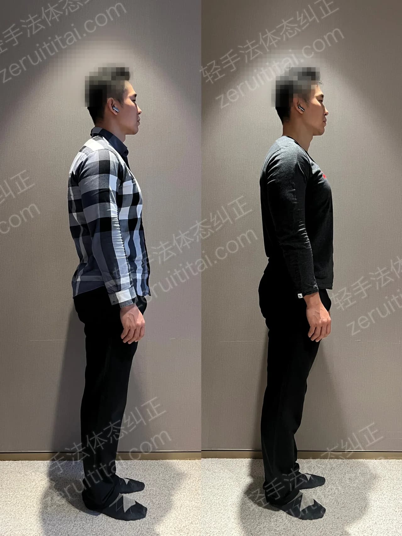 单次矫正案例对比 108