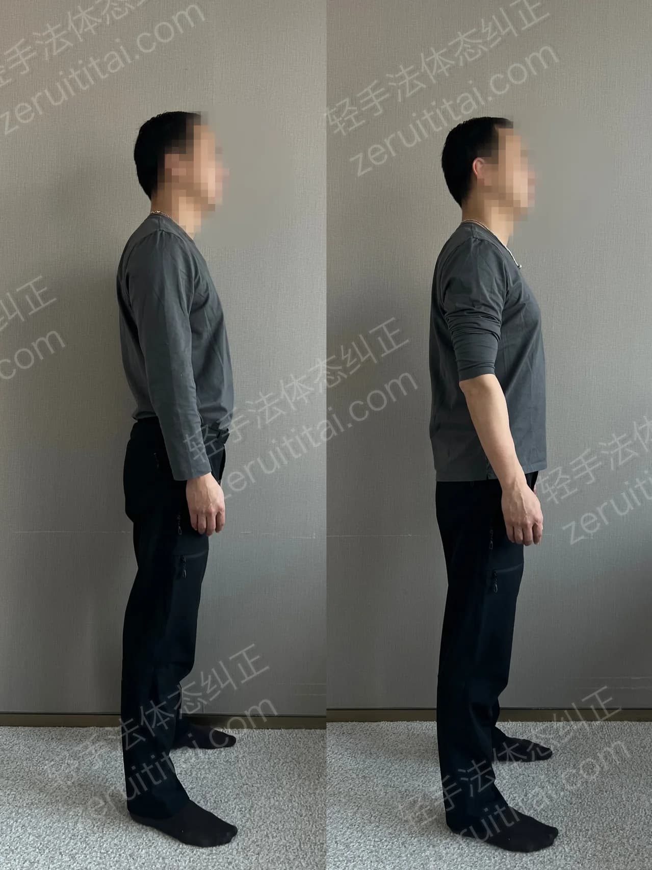 单次矫正案例对比 109