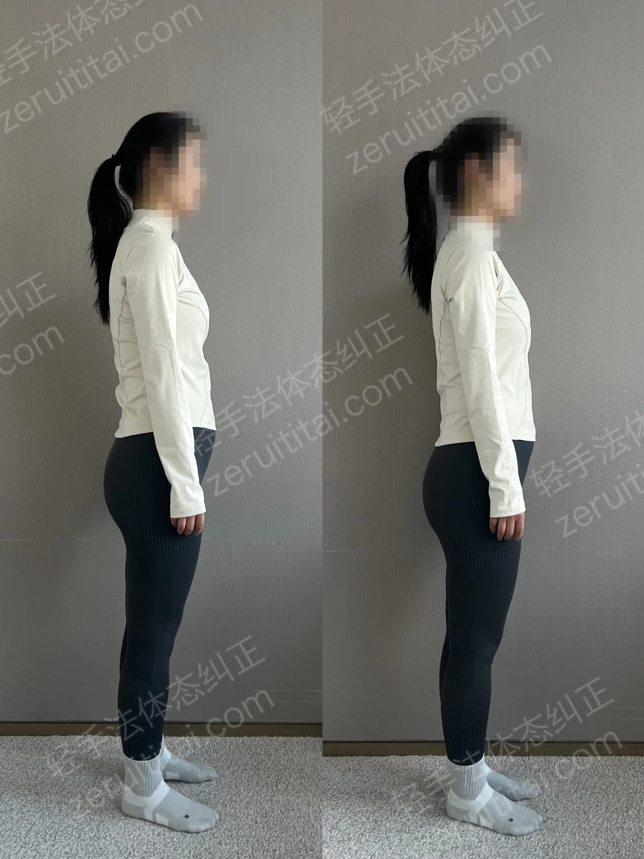 单次矫正案例对比 110