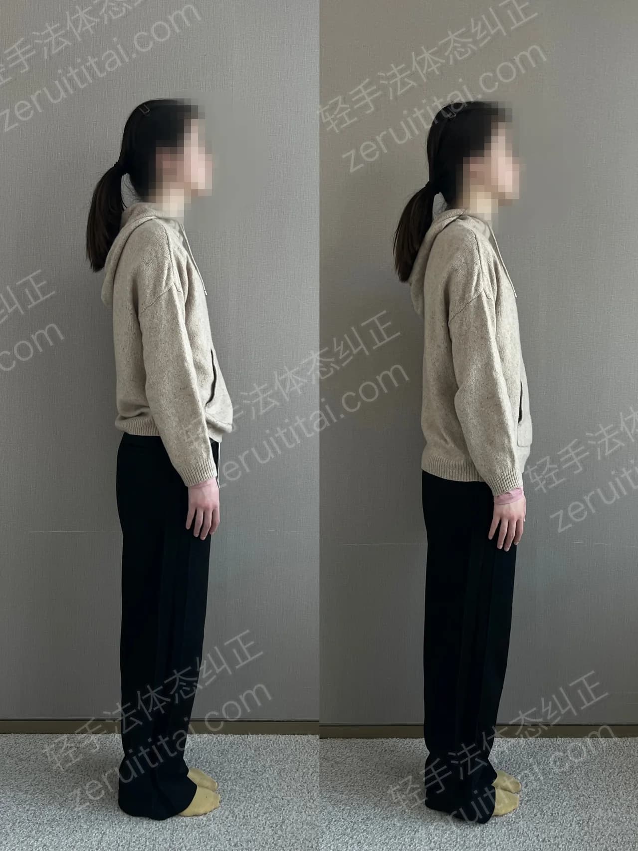 单次矫正案例对比 112