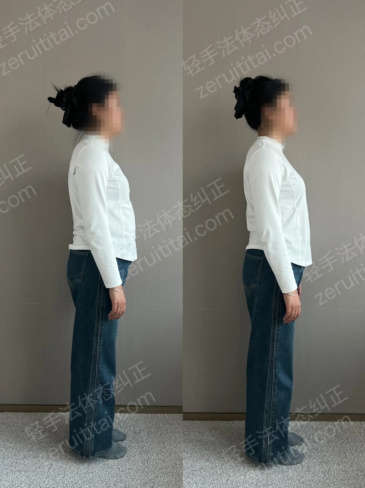 单次矫正案例对比 113