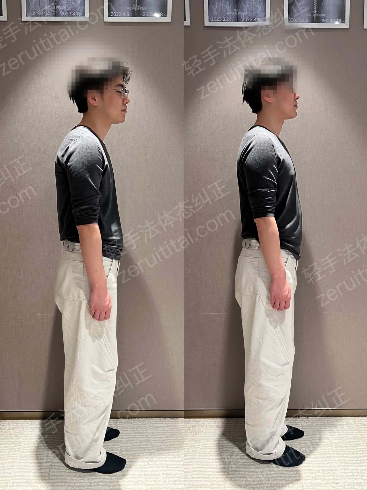 单次矫正案例对比 123