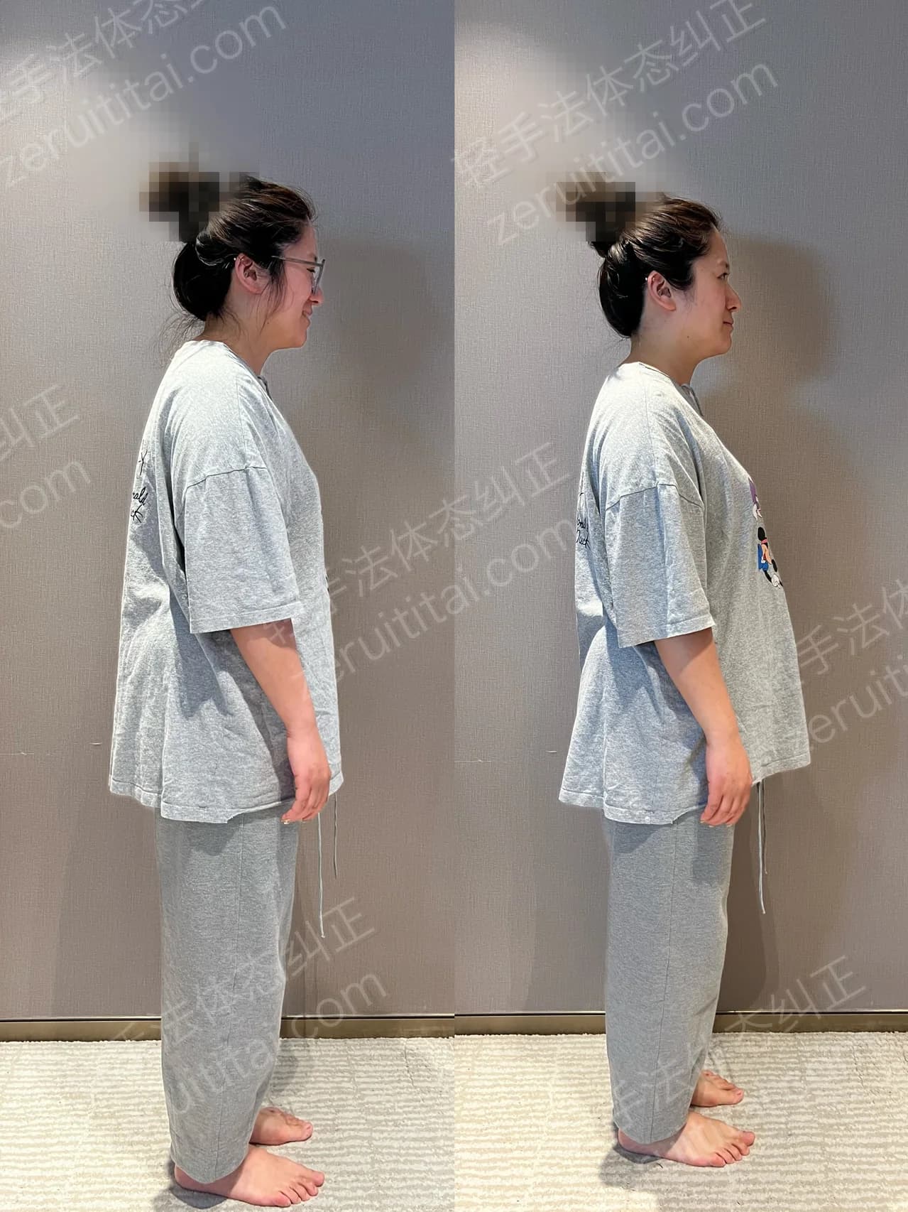单次矫正案例对比 127