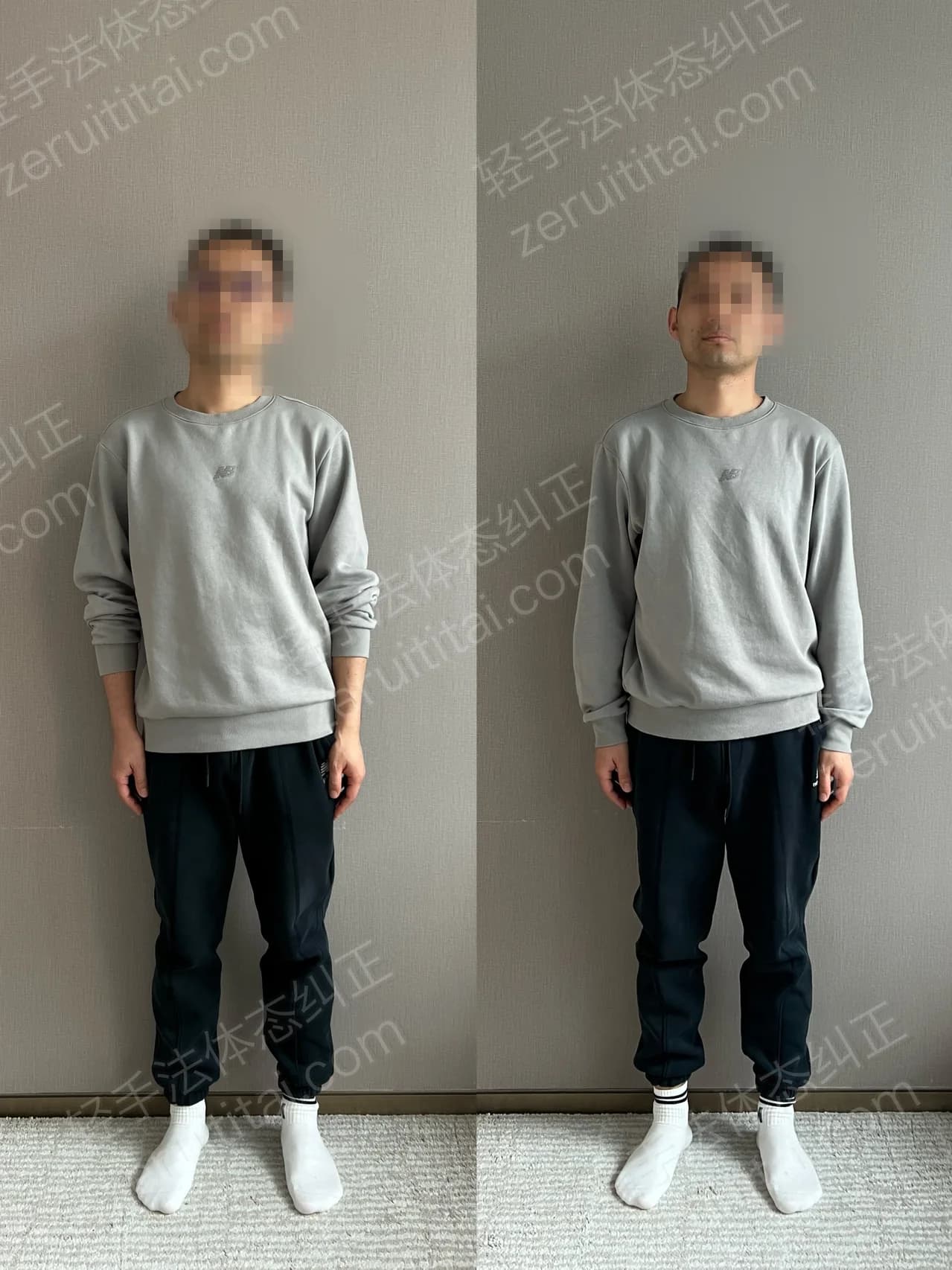 单次矫正案例对比 128