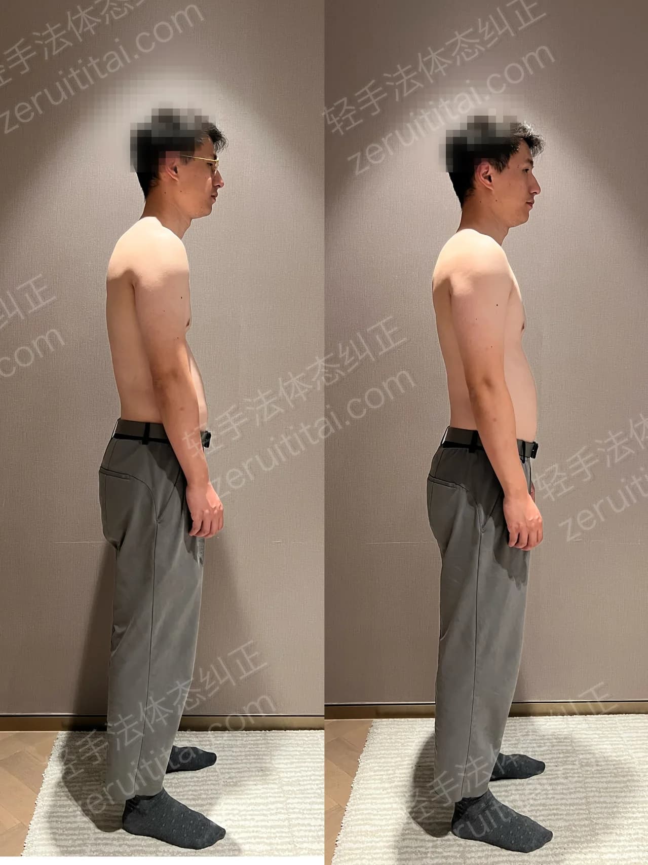 单次矫正案例对比 130