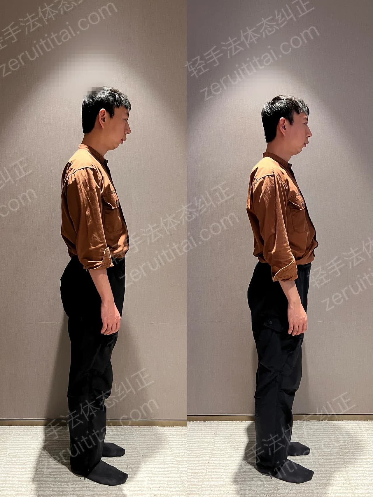 单次矫正案例对比 131