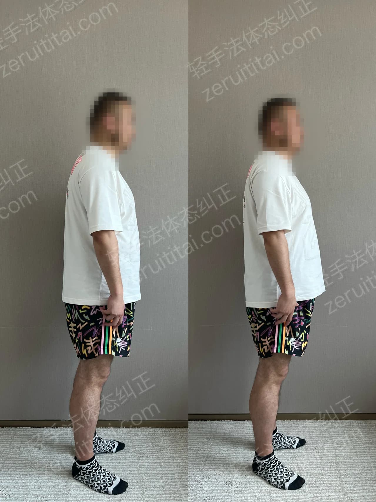 单次矫正案例对比 134