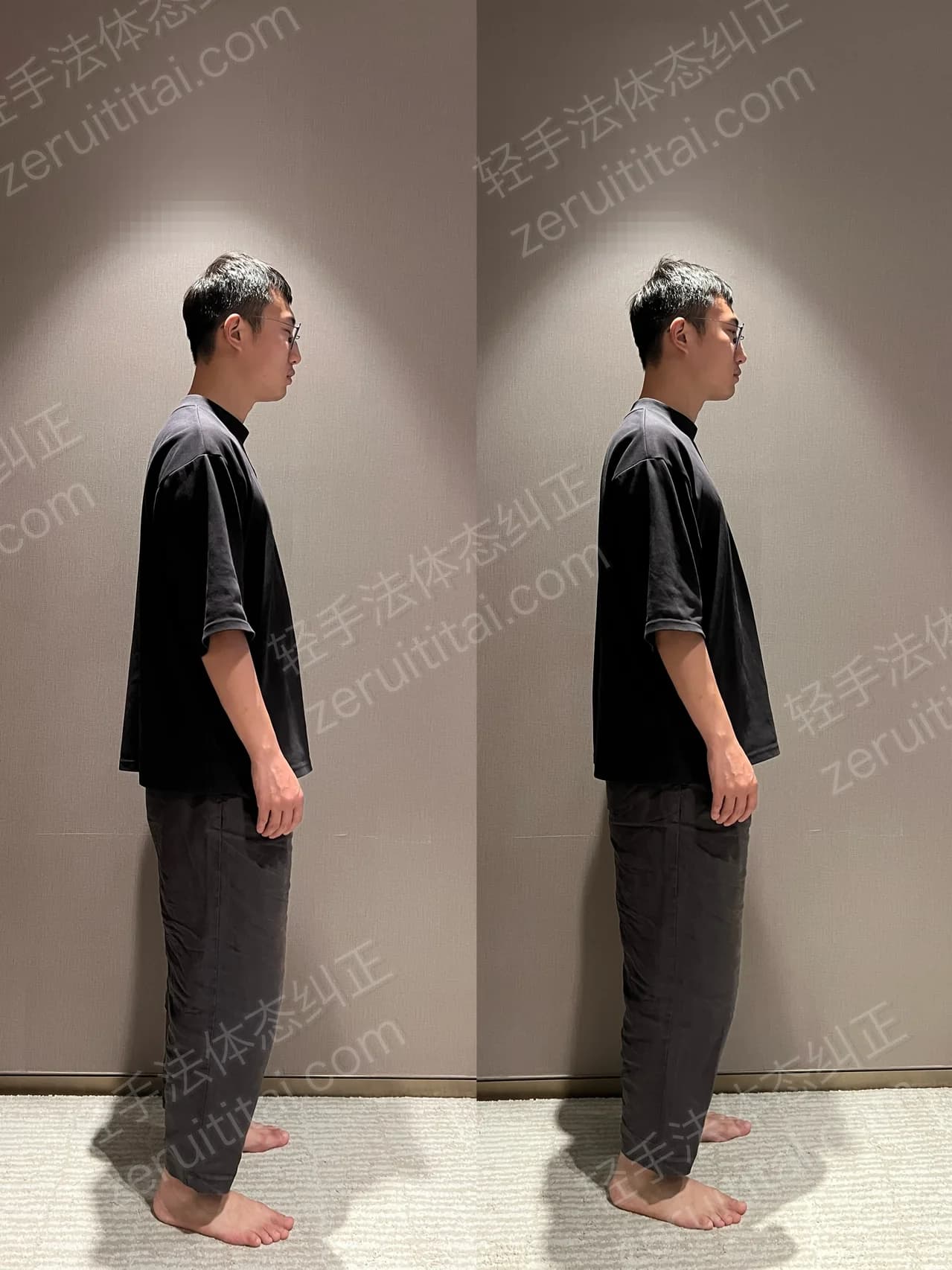 单次矫正案例对比 135