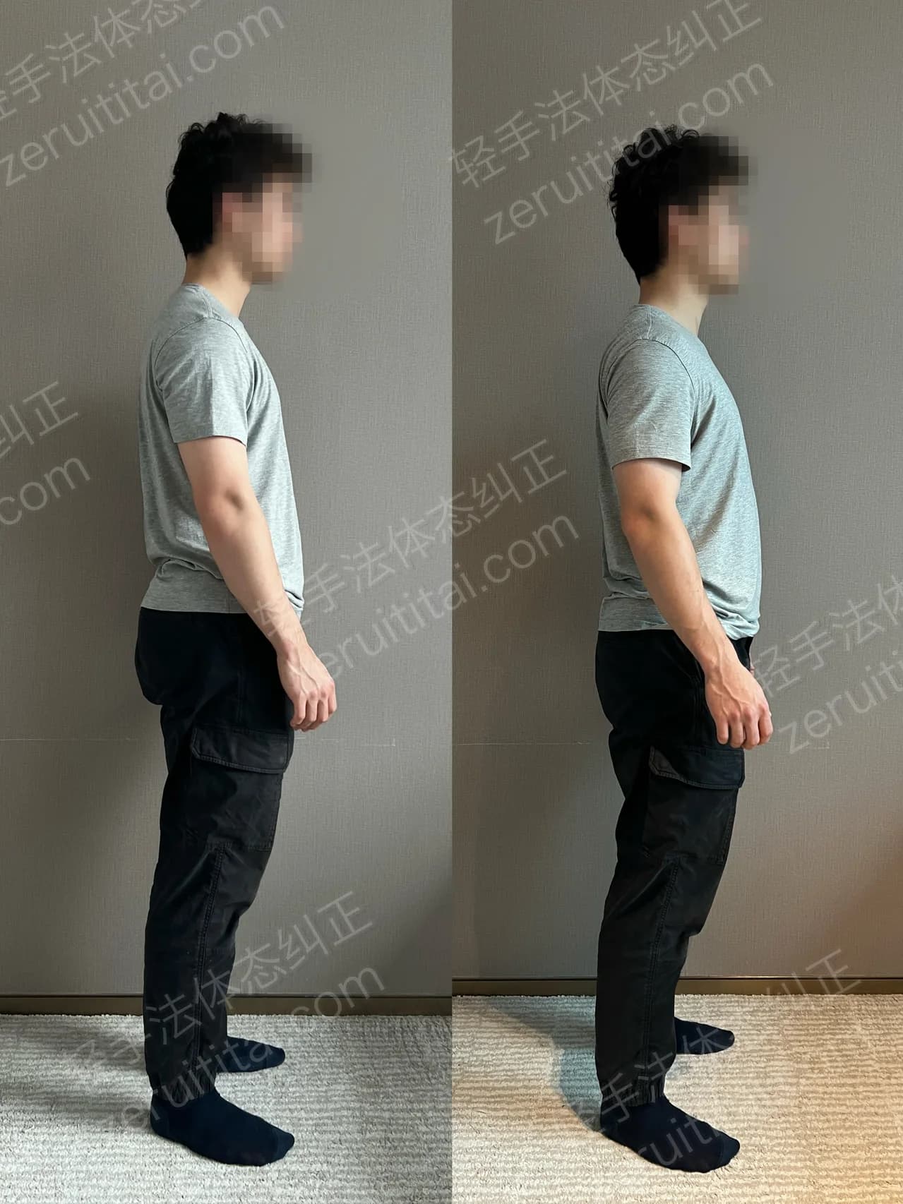 单次矫正案例对比 136