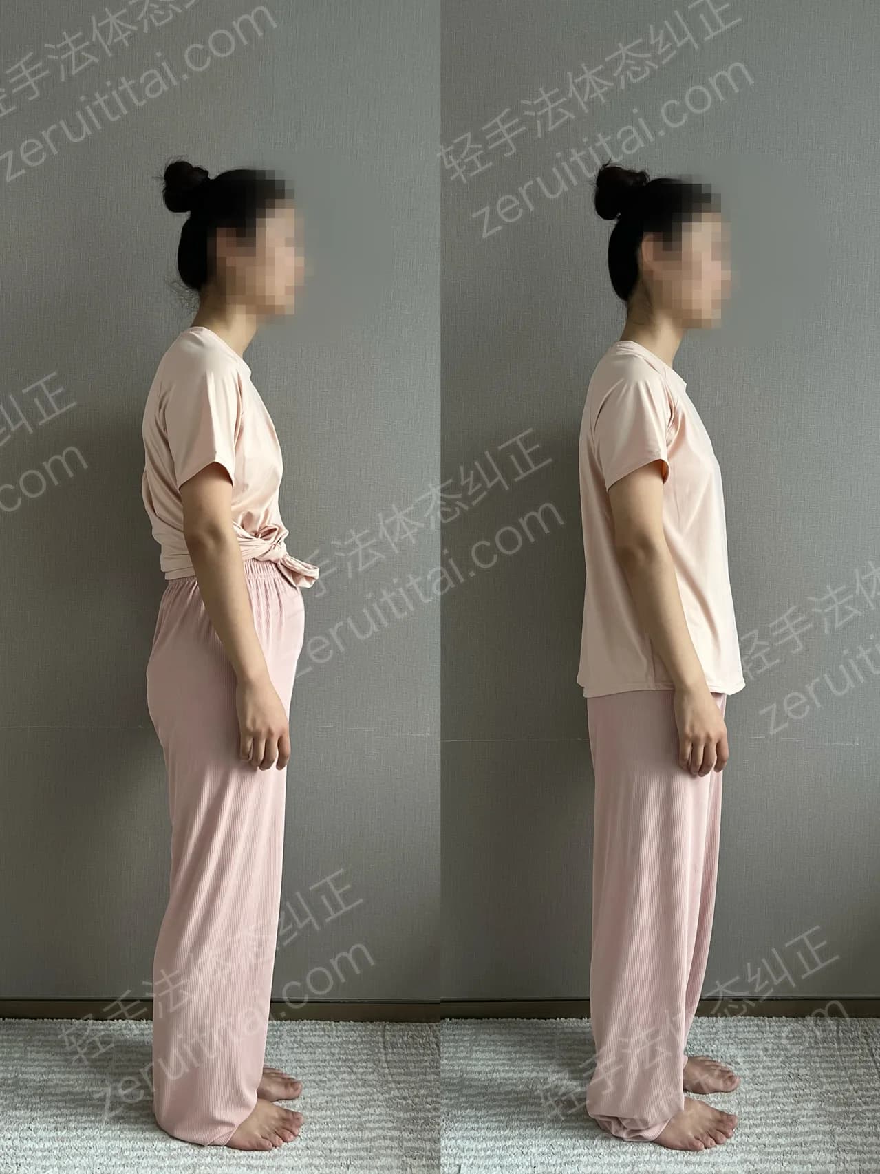 单次矫正案例对比 137