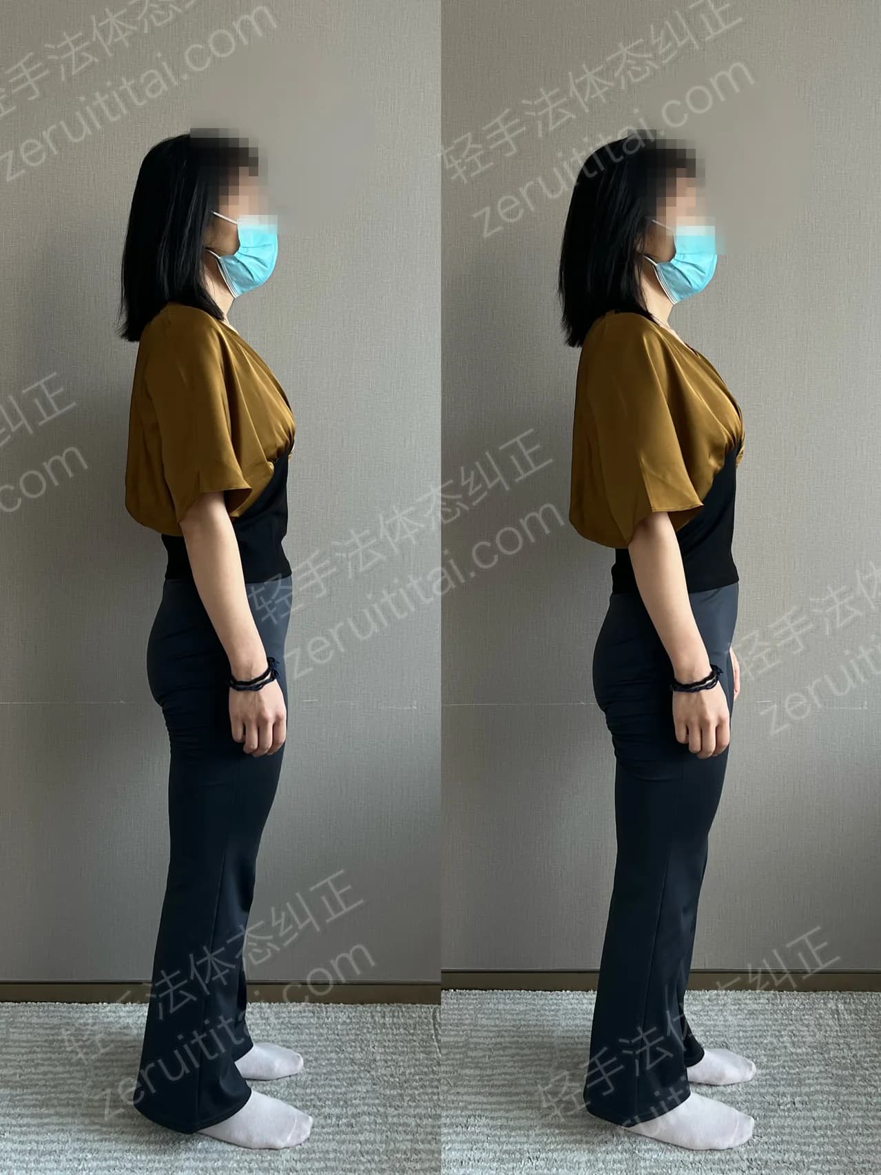 单次矫正案例对比 139
