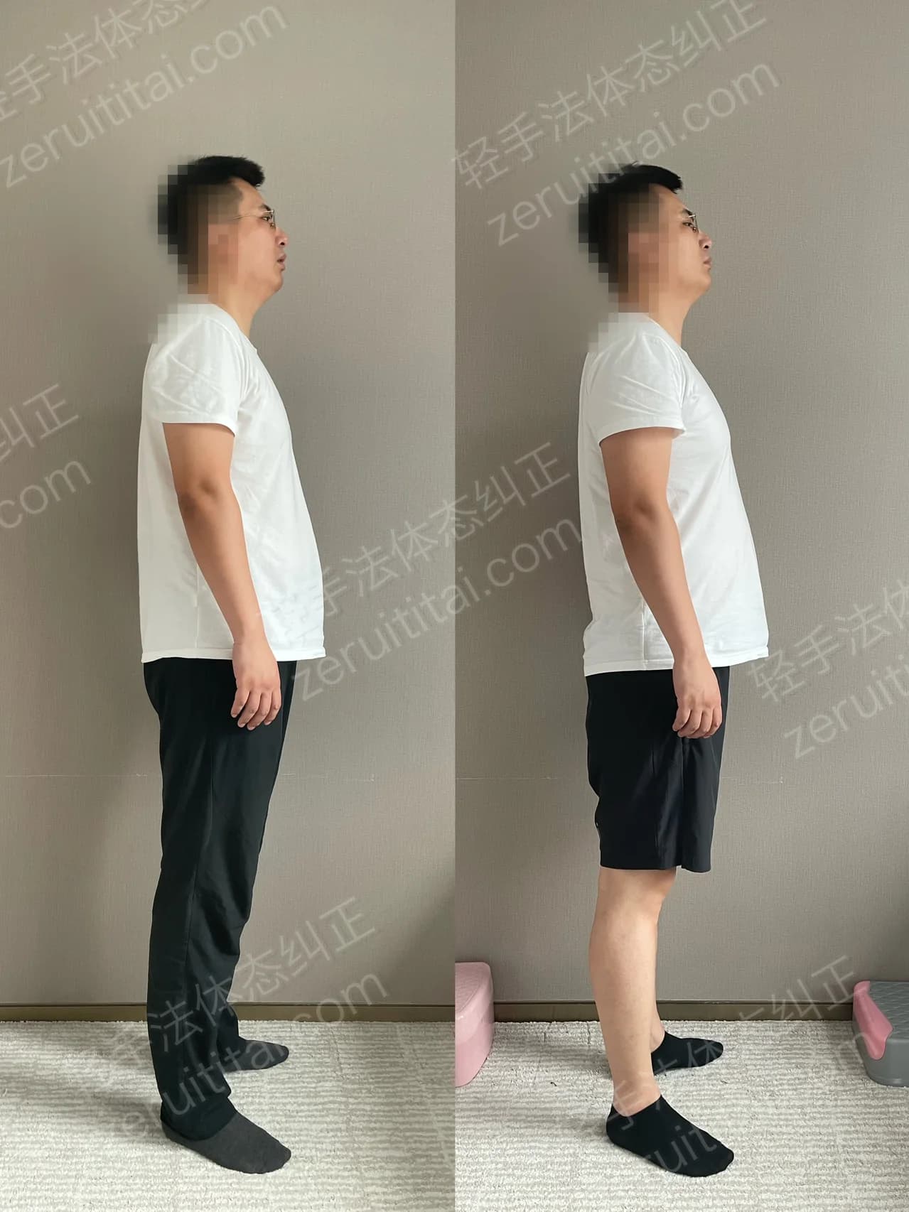 单次矫正案例对比 142