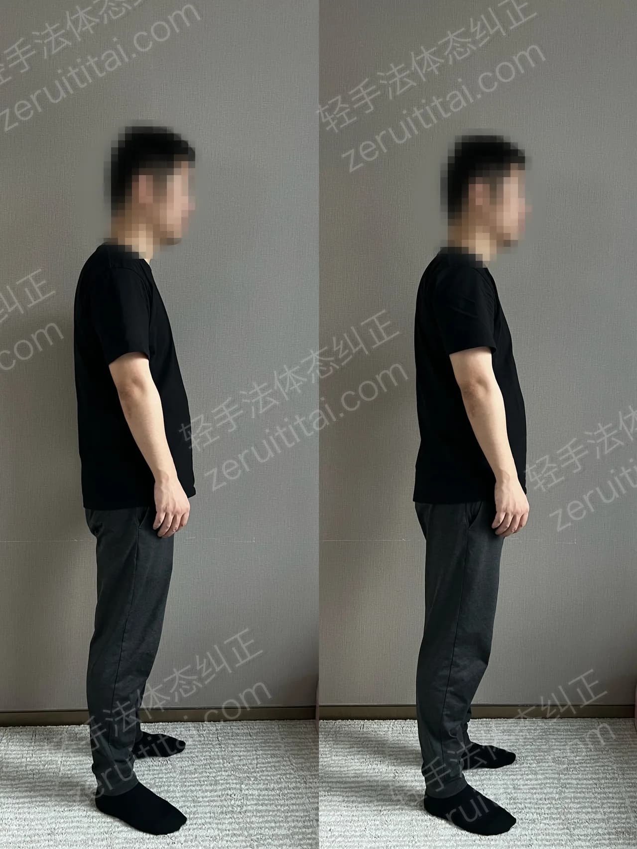 单次矫正案例对比 143