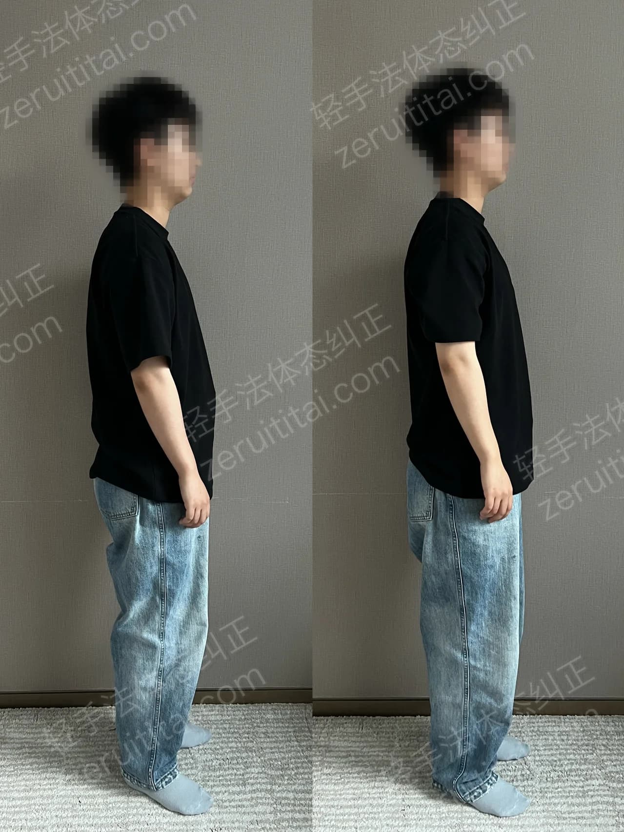 单次矫正案例对比 146