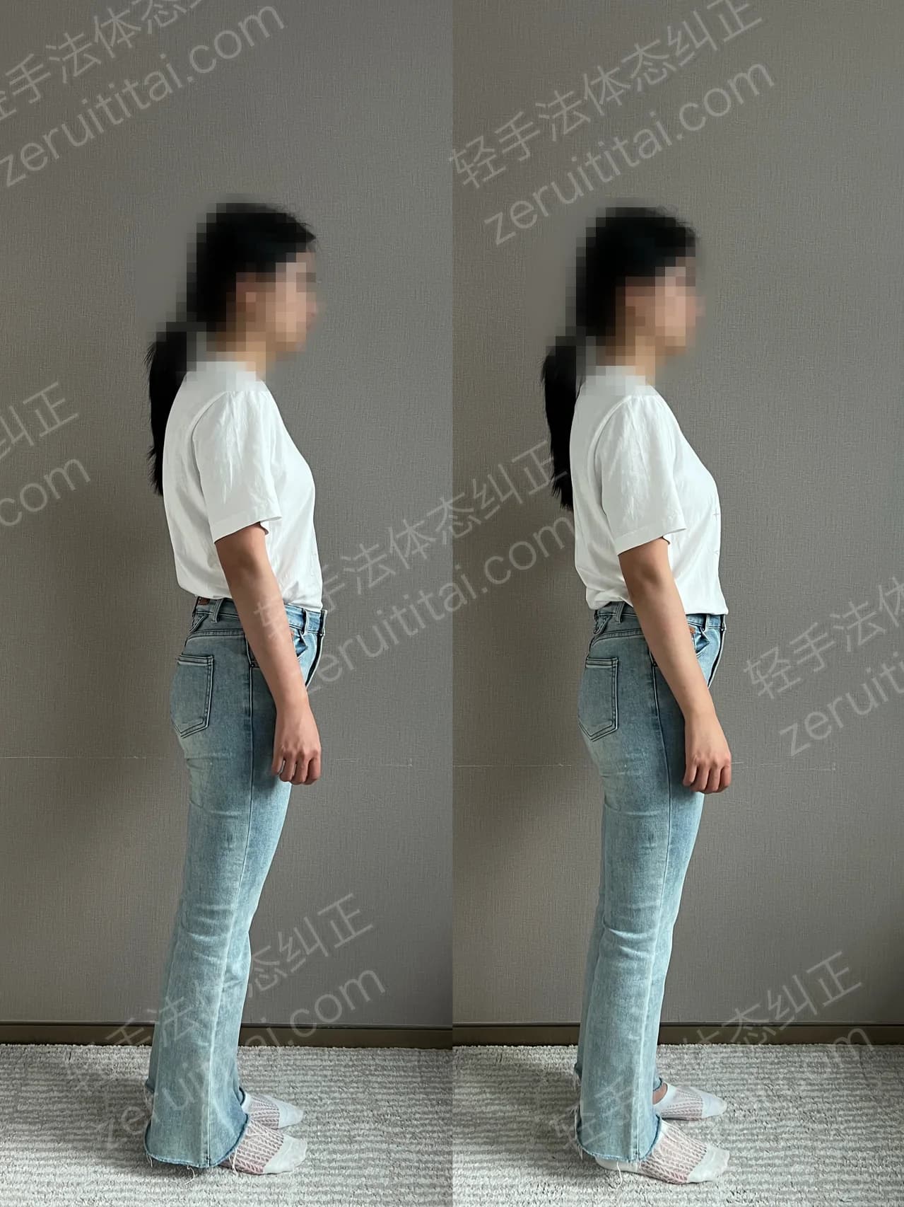 单次矫正案例对比 147