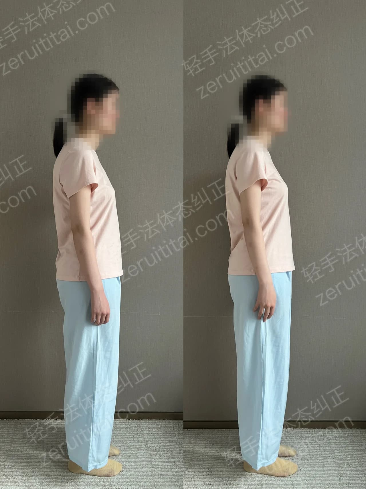 单次矫正案例对比 153